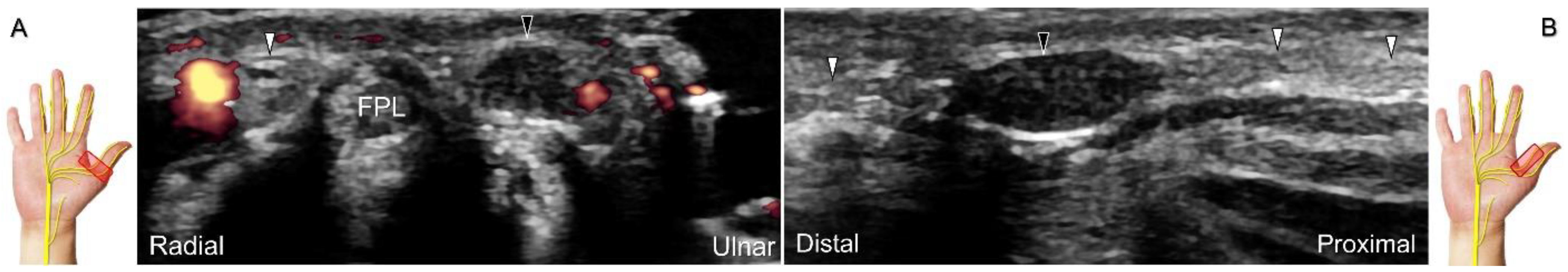 Diagnostics 13 01928 g031