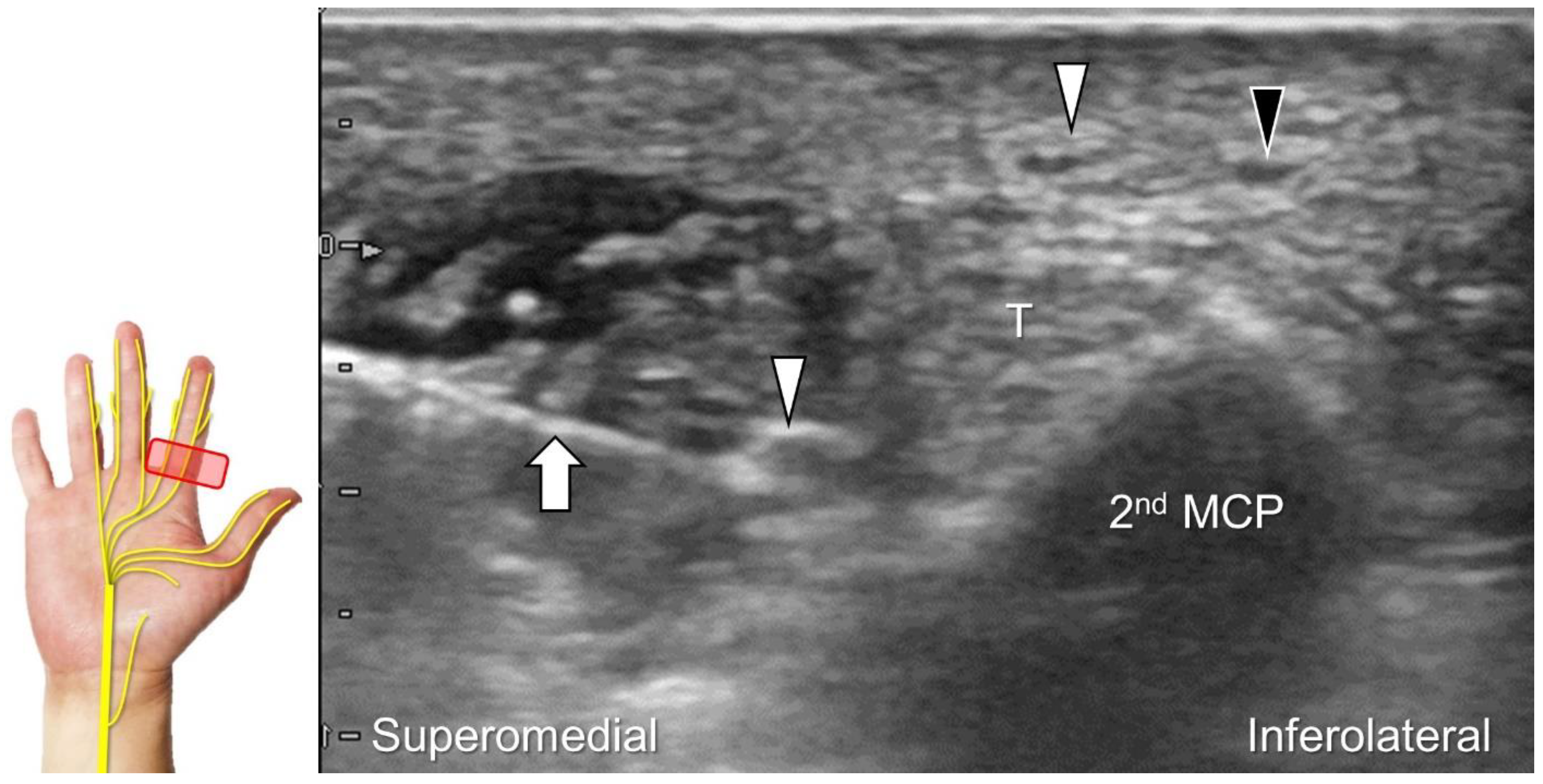 Diagnostics 13 01928 g032