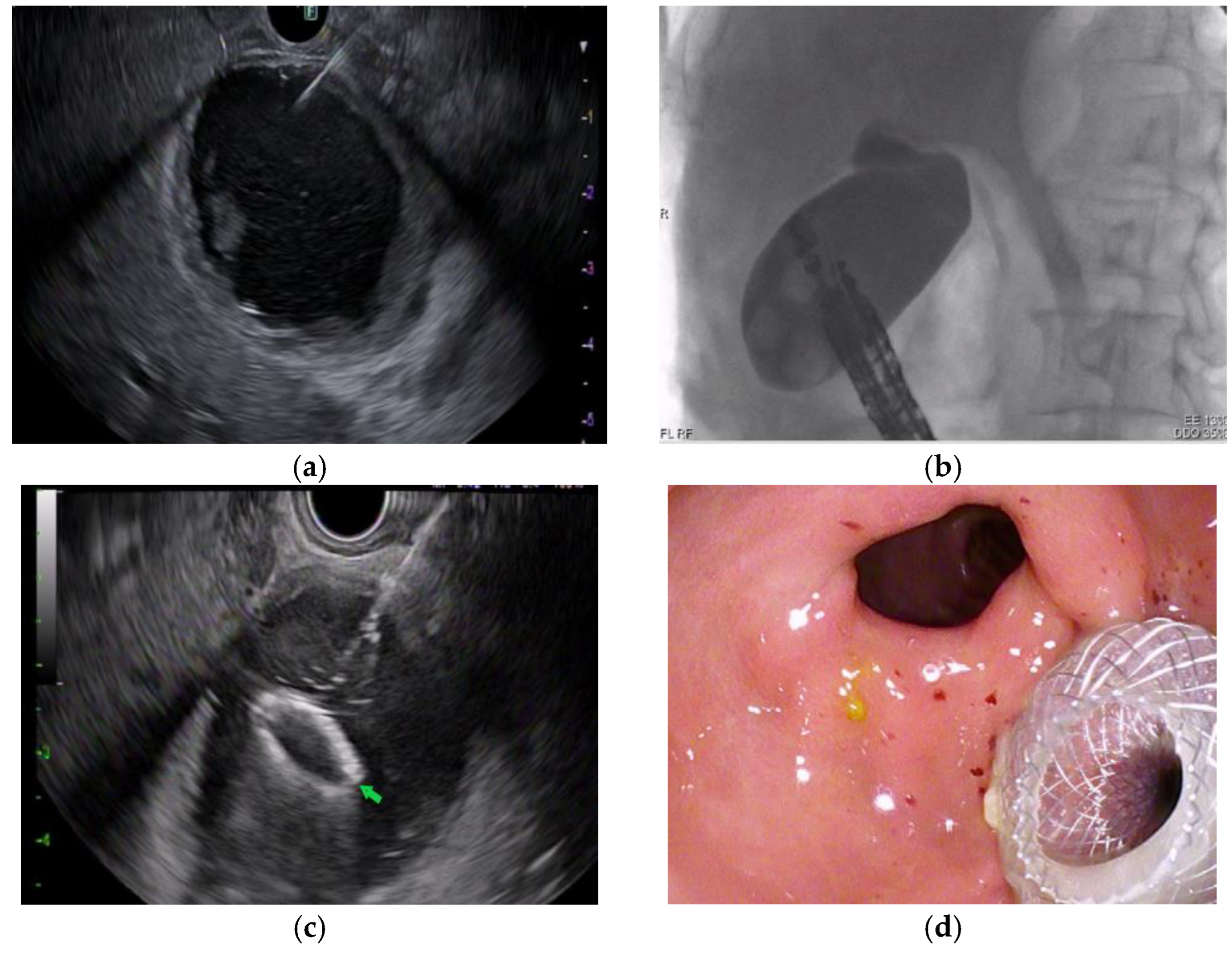 Diagnostics 13 01933 g002 Diagnostics 13 01933 g002