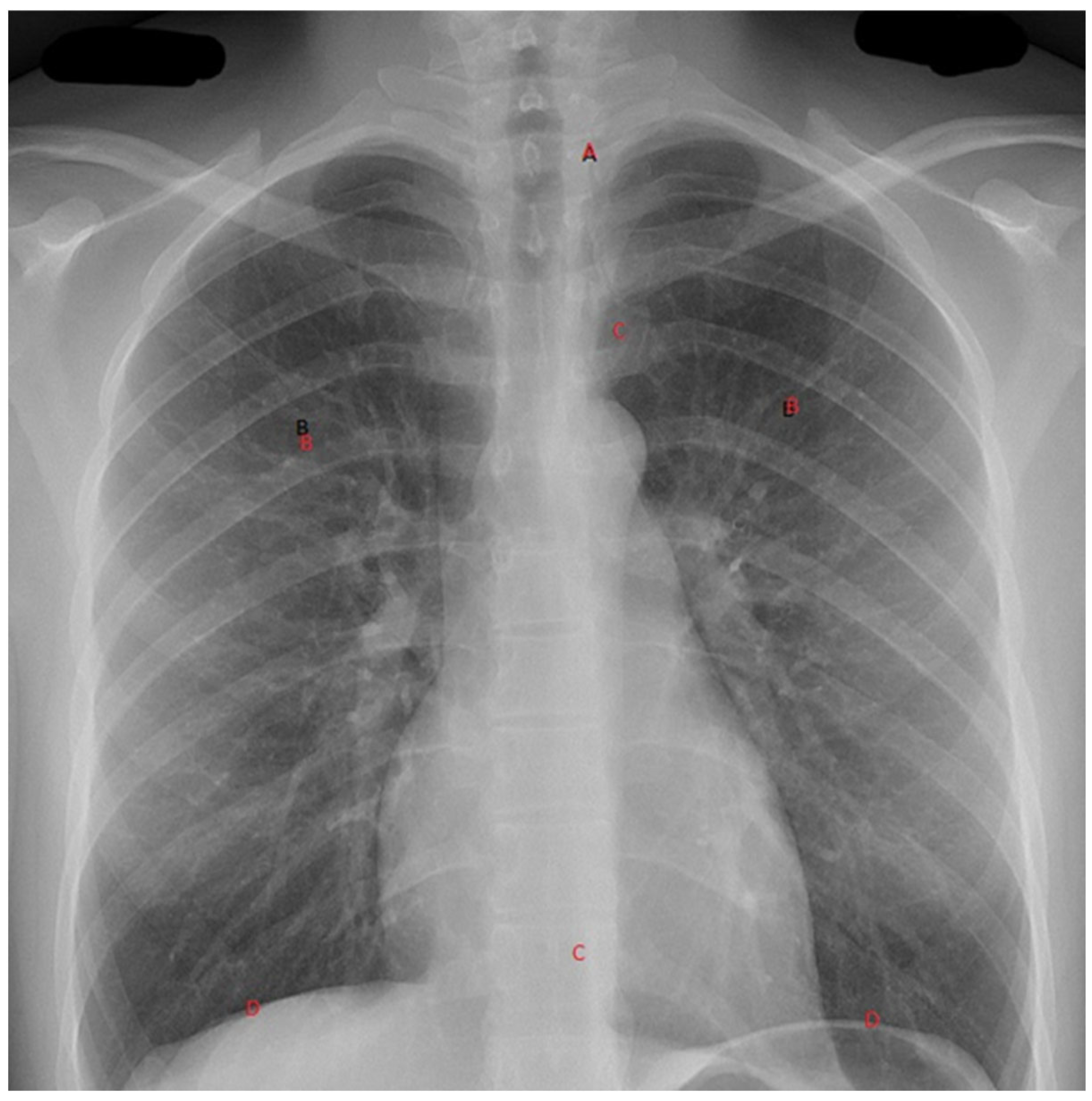 Diagnostics 13 01941 g003