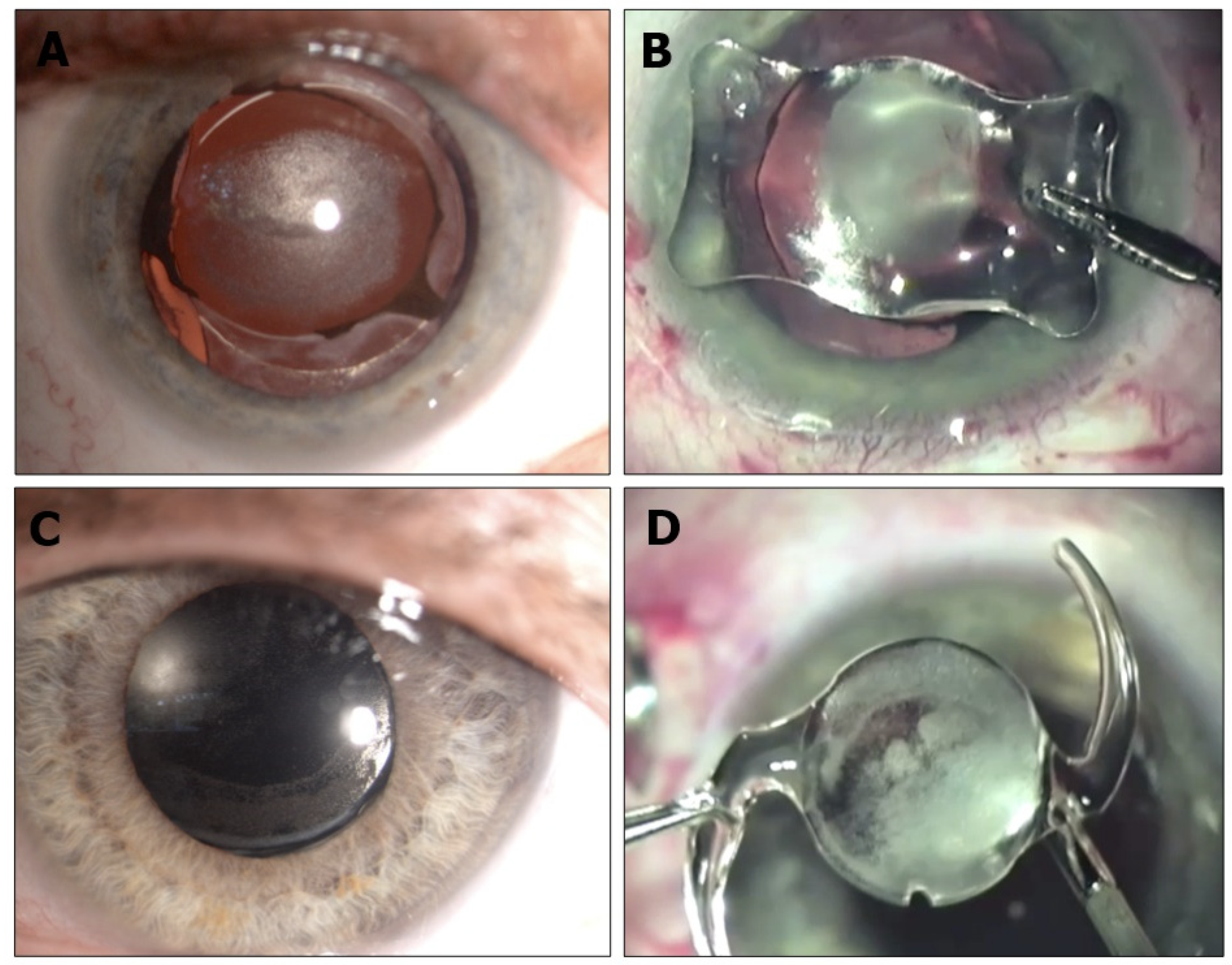 Diagnostics 13 01943 g002 Diagnostics 13 01943 g002