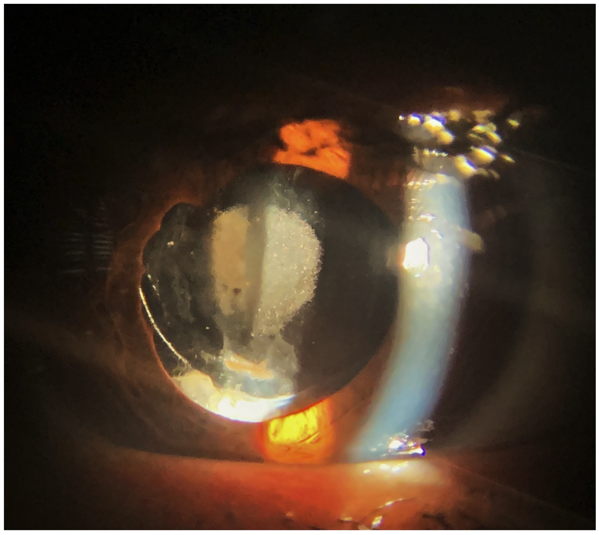 Diagnostics 13 01943 g004 Diagnostics 13 01943 g004