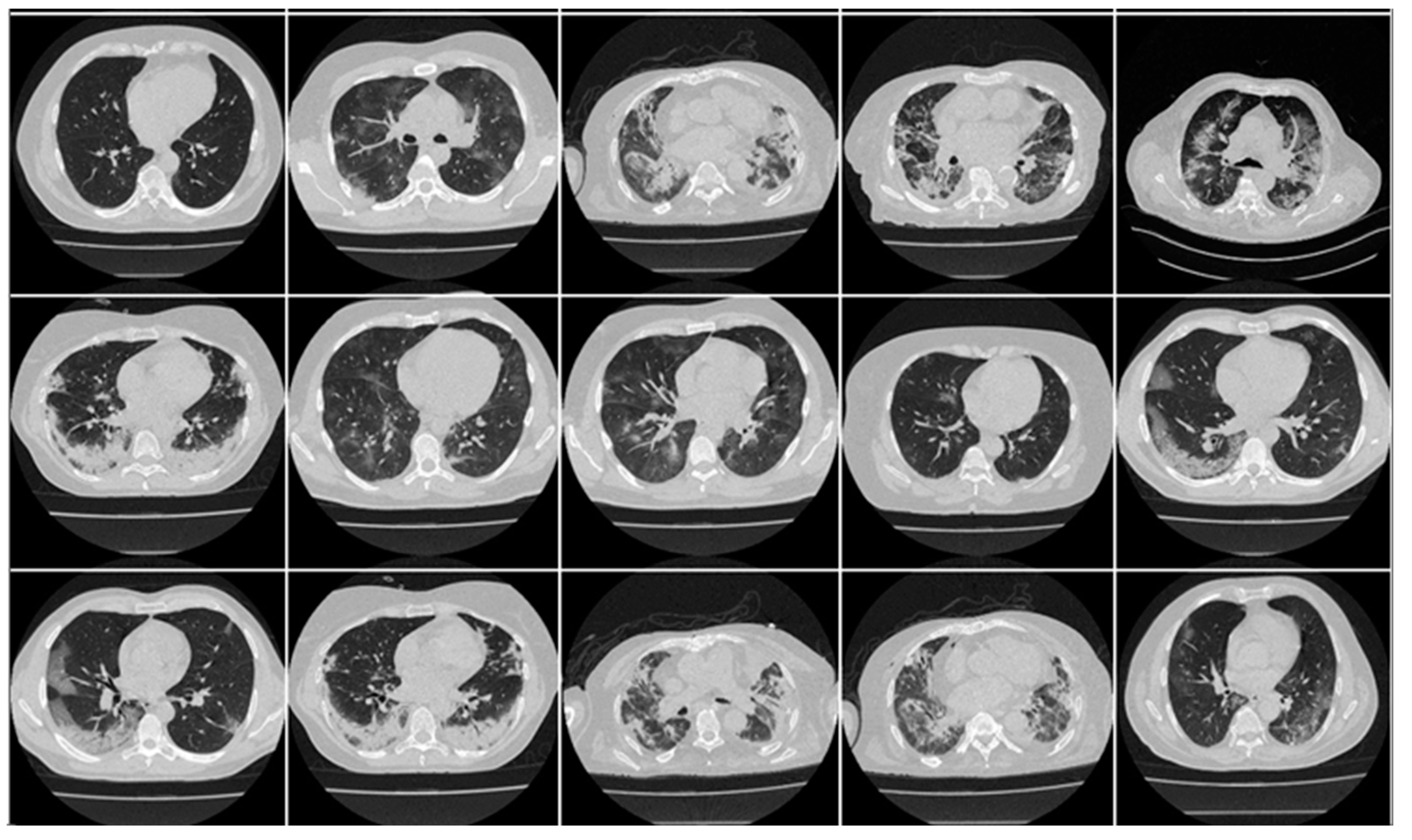 Diagnostics 13 01954 g001 Diagnostics 13 01954 g001