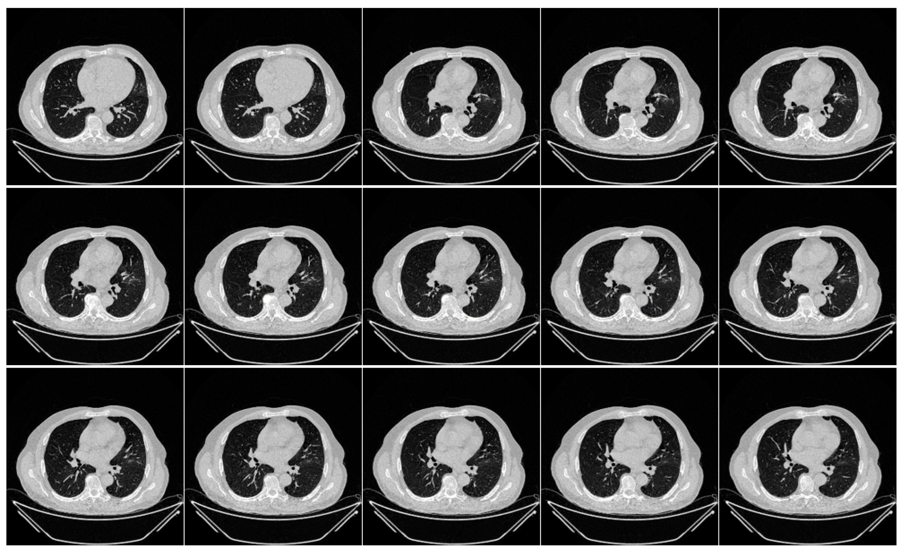 Diagnostics 13 01954 g002 Diagnostics 13 01954 g002