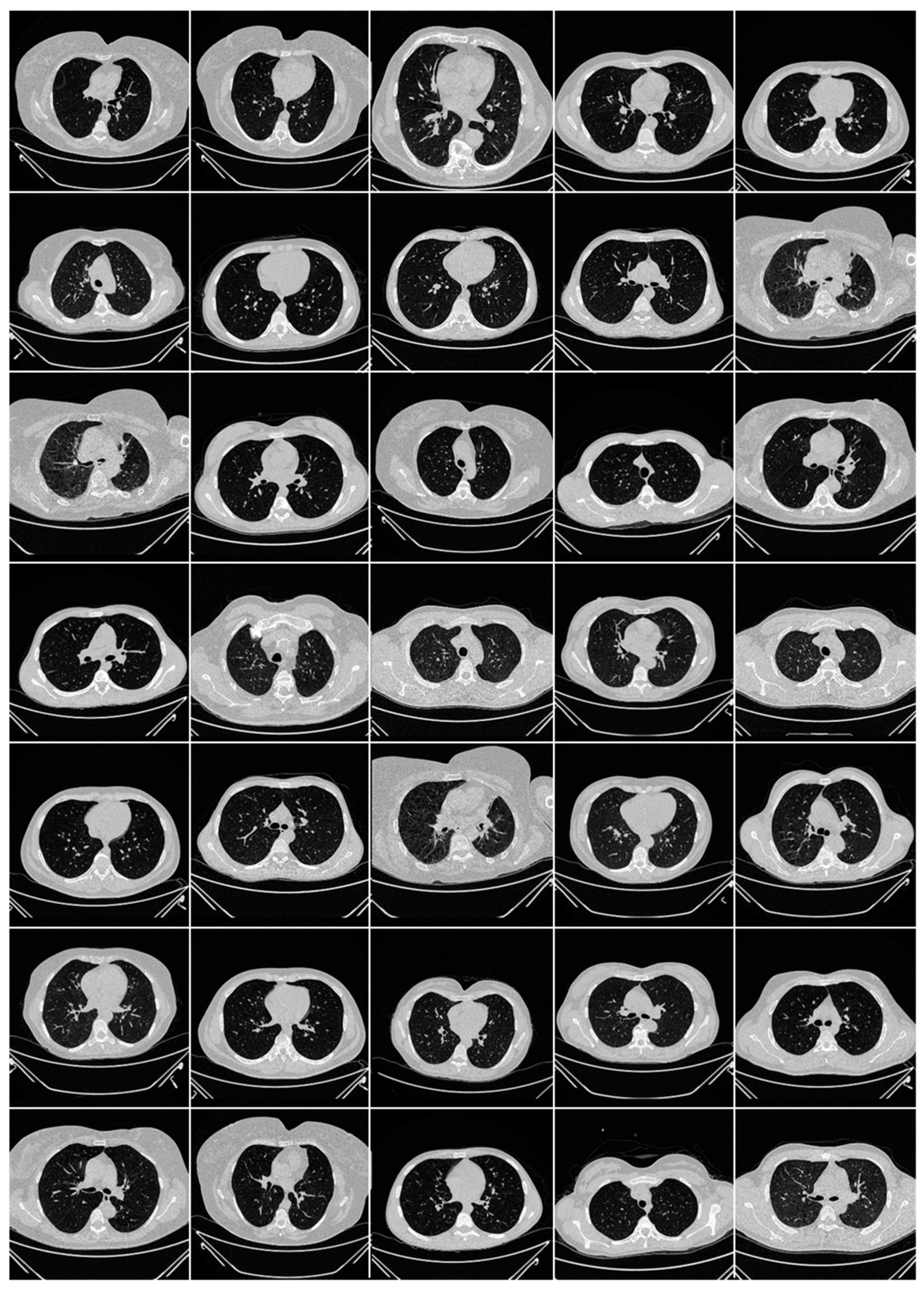 Diagnostics 13 01954 g0a2 Diagnostics 13 01954 g0a2