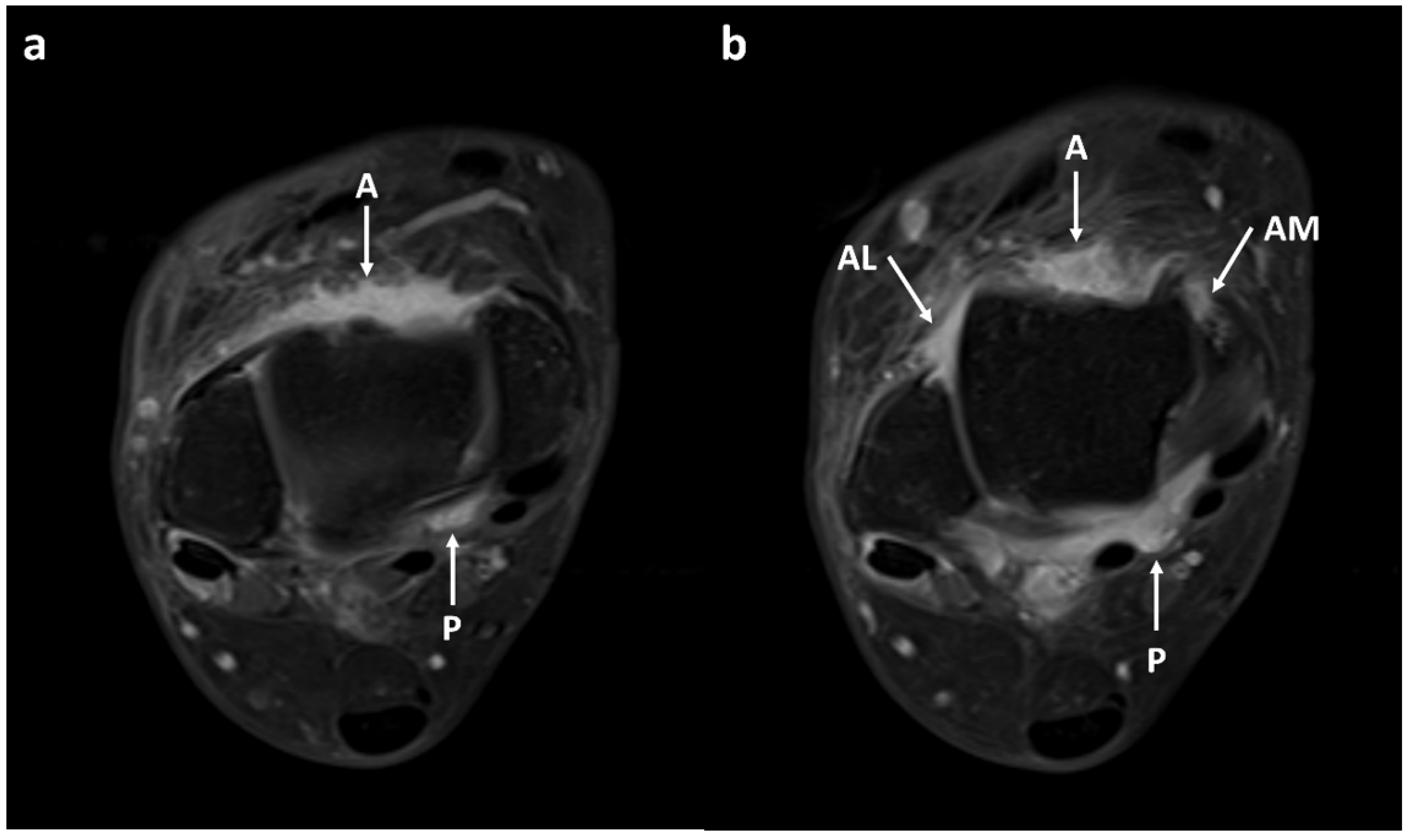 Diagnostics 13 01960 g002 Diagnostics 13 01960 g002