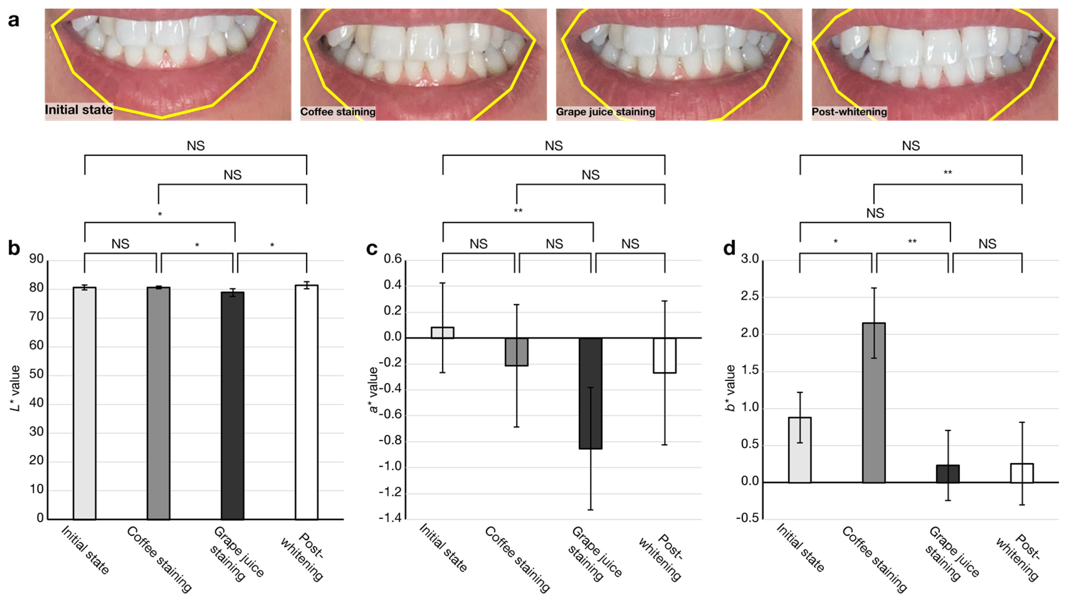 Diagnostics 13 01969 g005 Diagnostics 13 01969 g005
