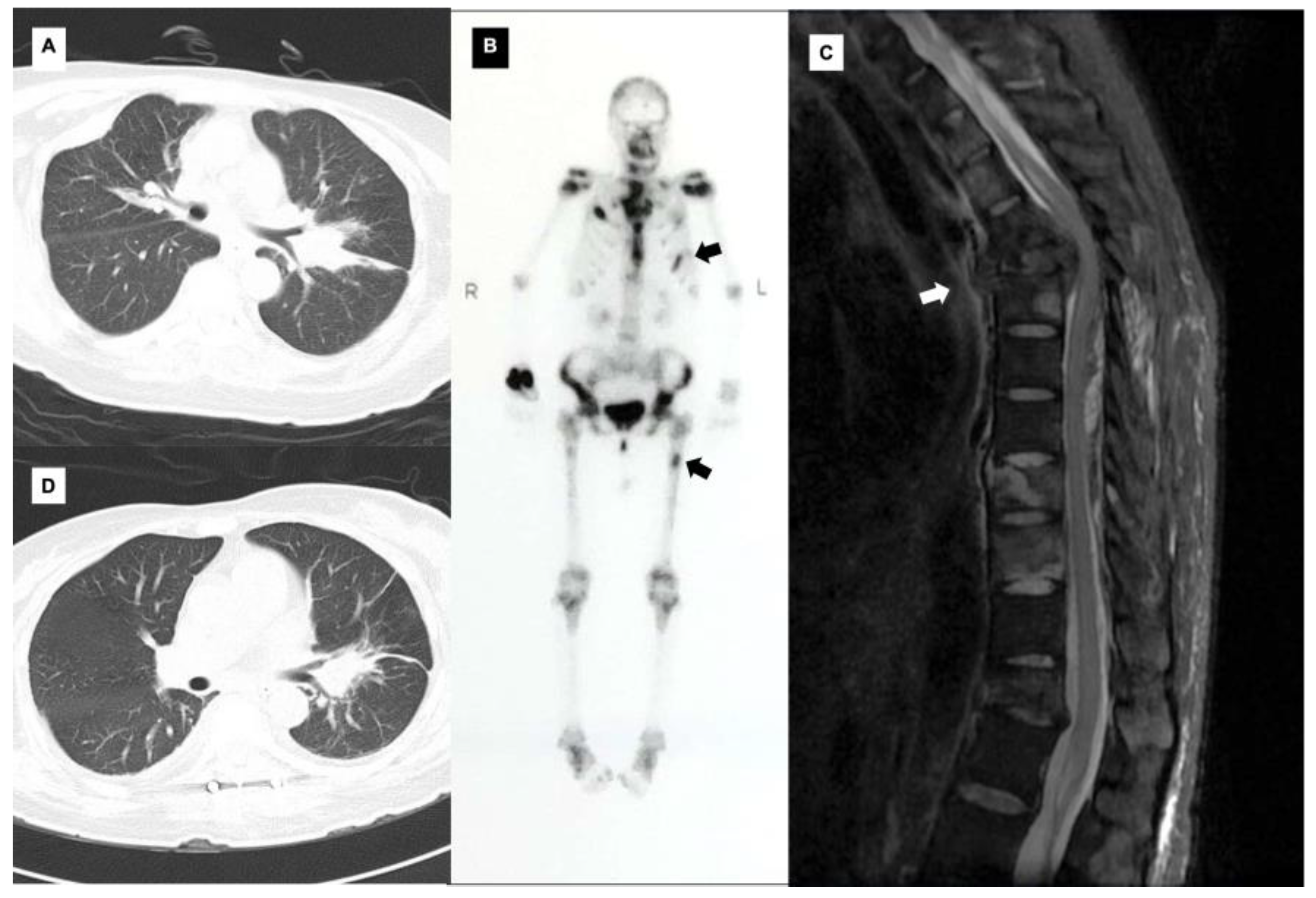 Diagnostics 13 01970 g002 Diagnostics 13 01970 g002