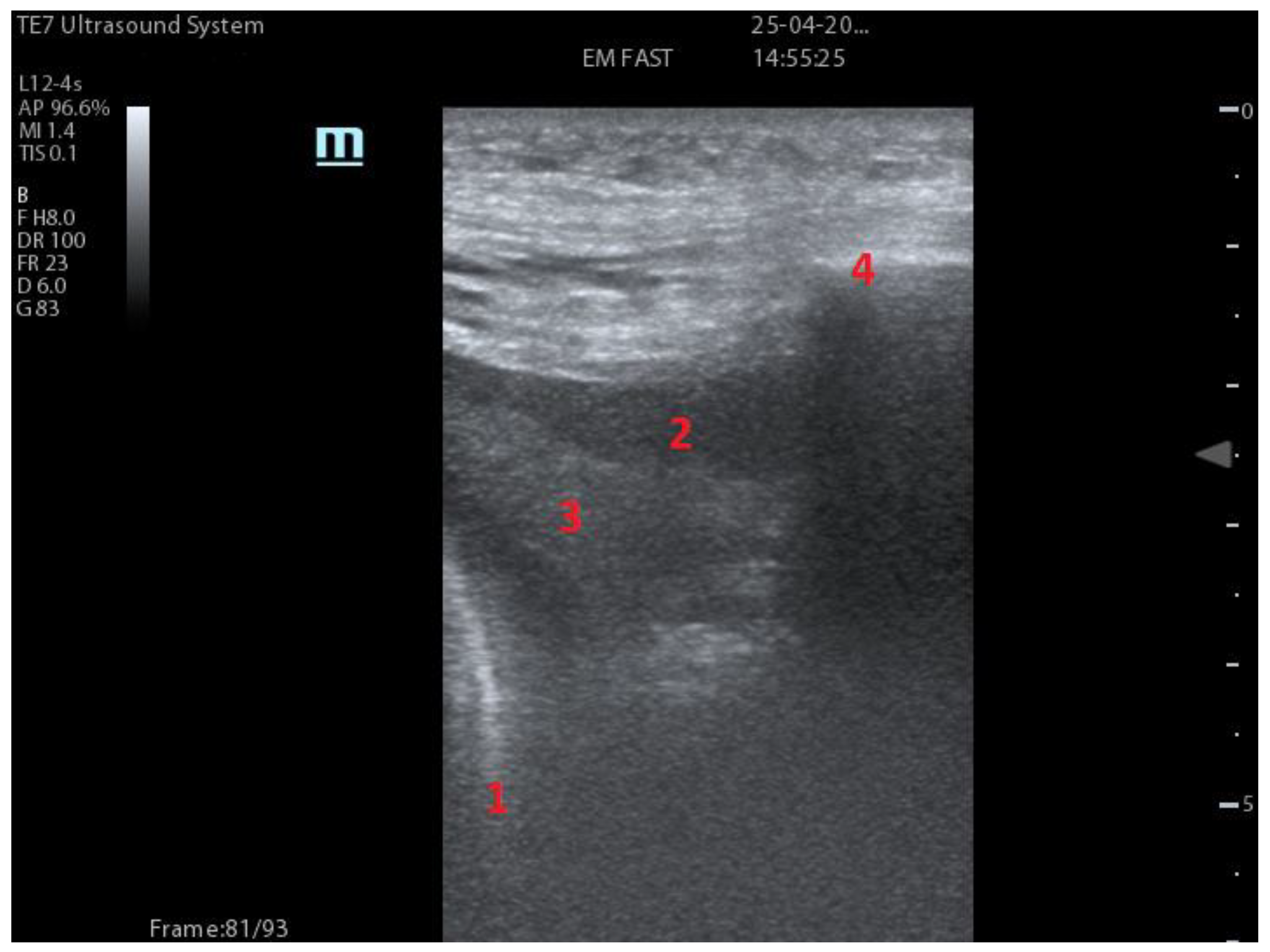 Diagnostics 13 01972 g002