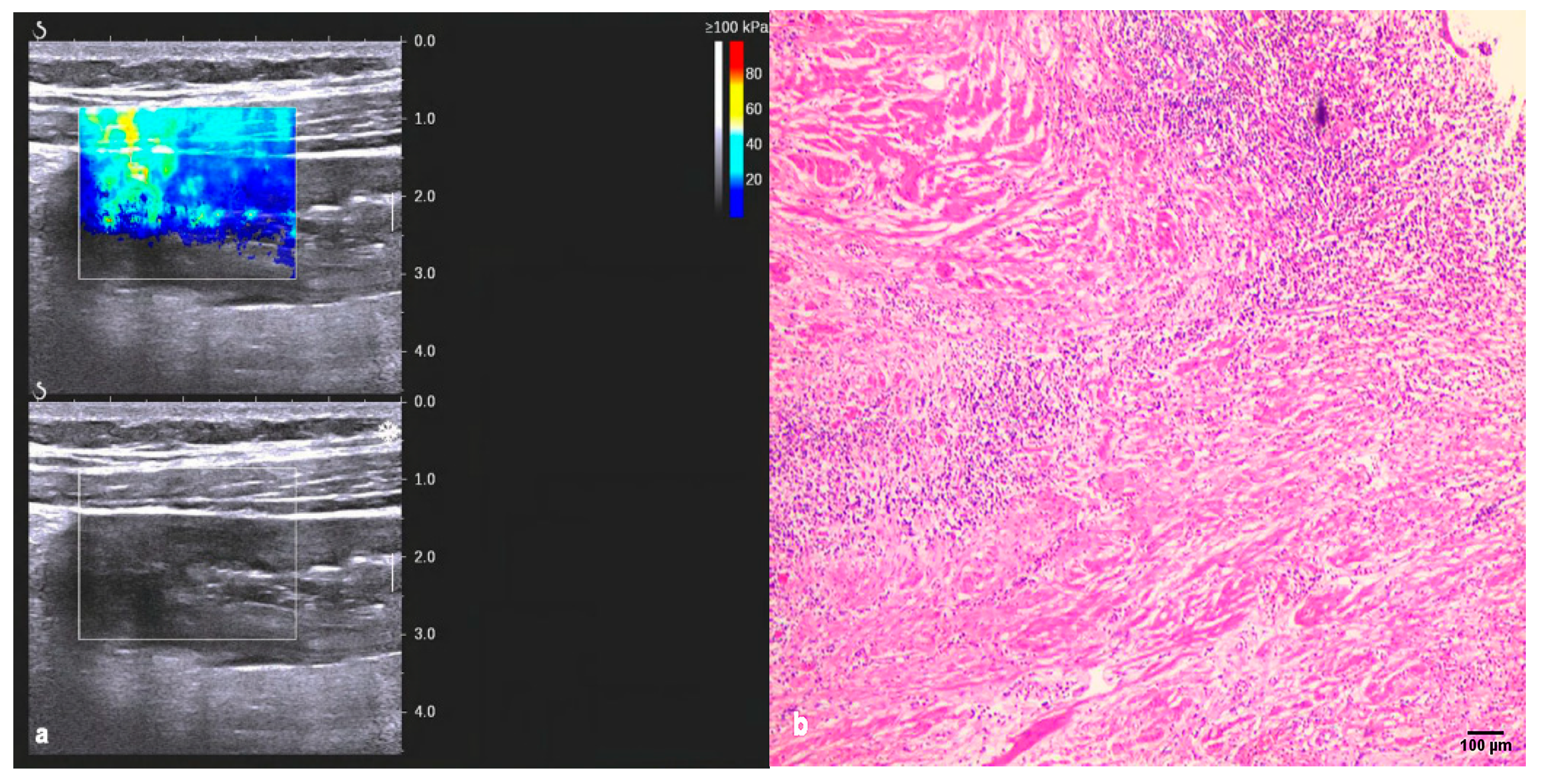 Diagnostics 13 01980 g003a Diagnostics 13 01980 g003a