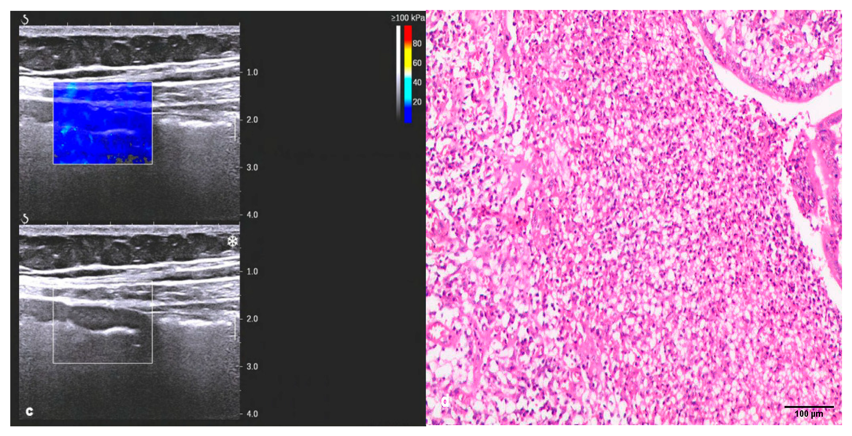 Diagnostics 13 01980 g003b Diagnostics 13 01980 g003b