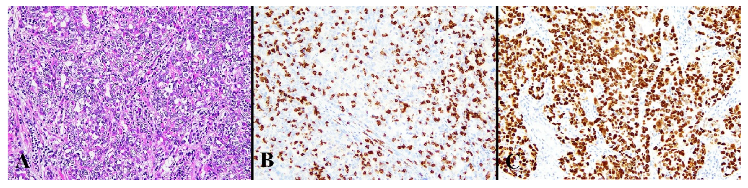 Diagnostics 13 01985 g004 Diagnostics 13 01985 g004