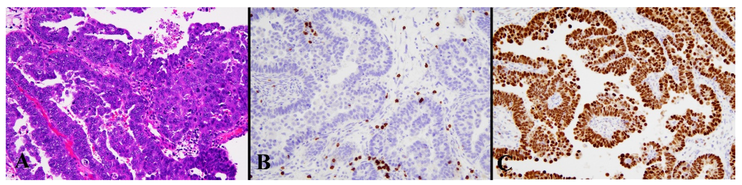 Diagnostics 13 01985 g005 Diagnostics 13 01985 g005