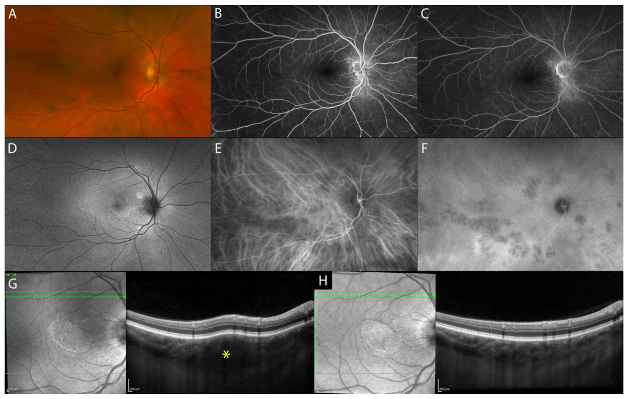 Diagnostics 13 01991 g002 Diagnostics 13 01991 g002