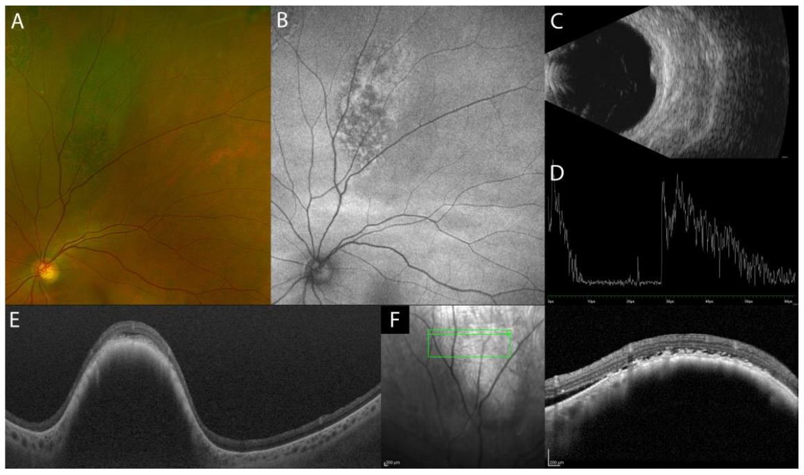 Diagnostics 13 01991 g005 Diagnostics 13 01991 g005