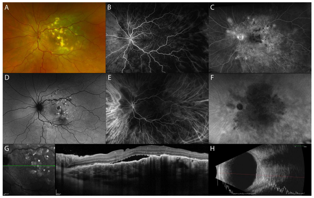 Diagnostics 13 01991 g006 Diagnostics 13 01991 g006