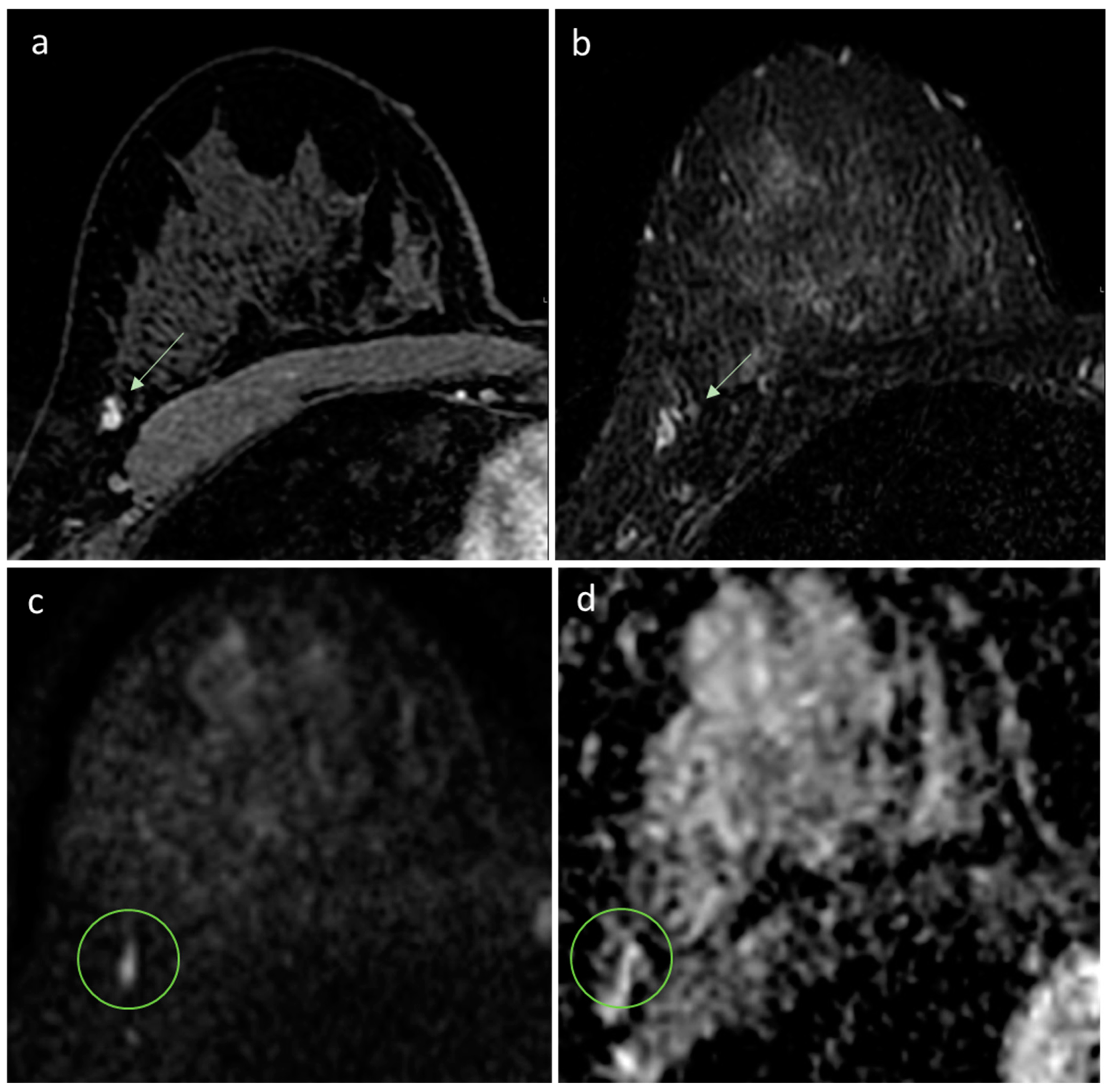 Diagnostics 13 01996 g002