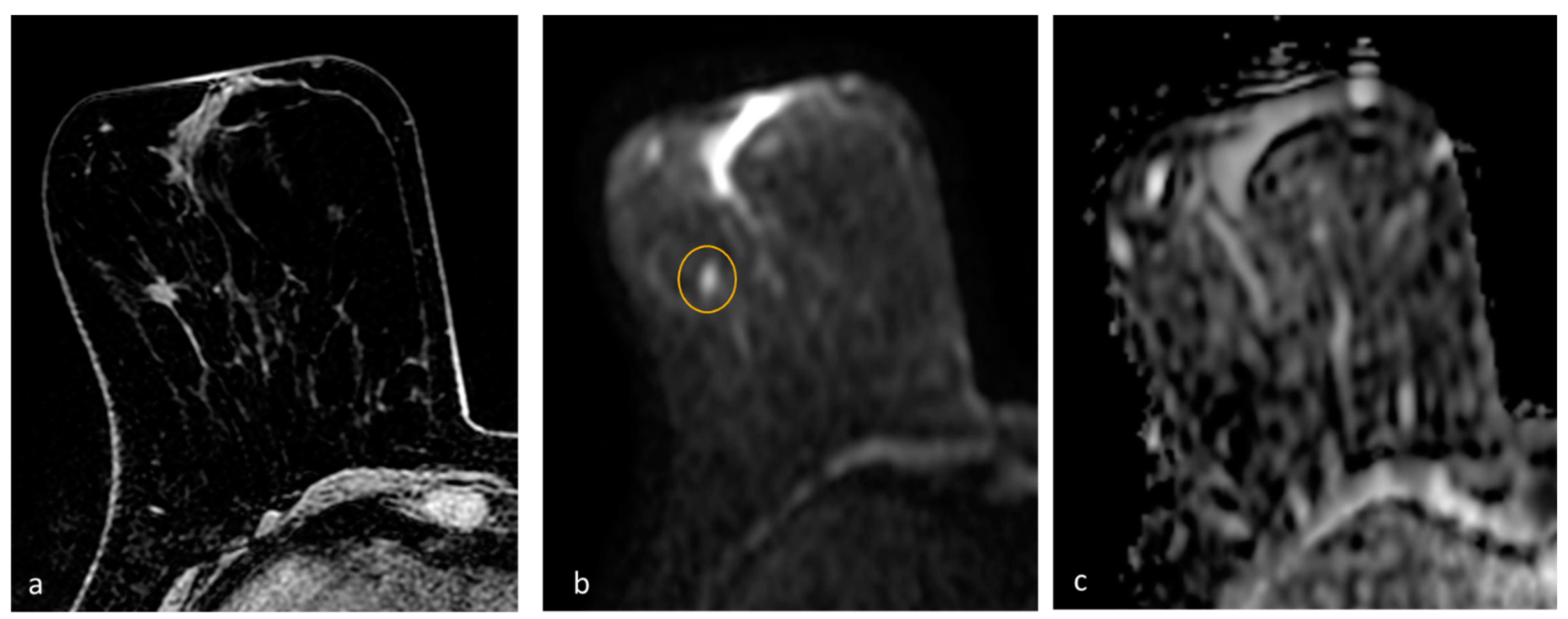 Diagnostics 13 01996 g003