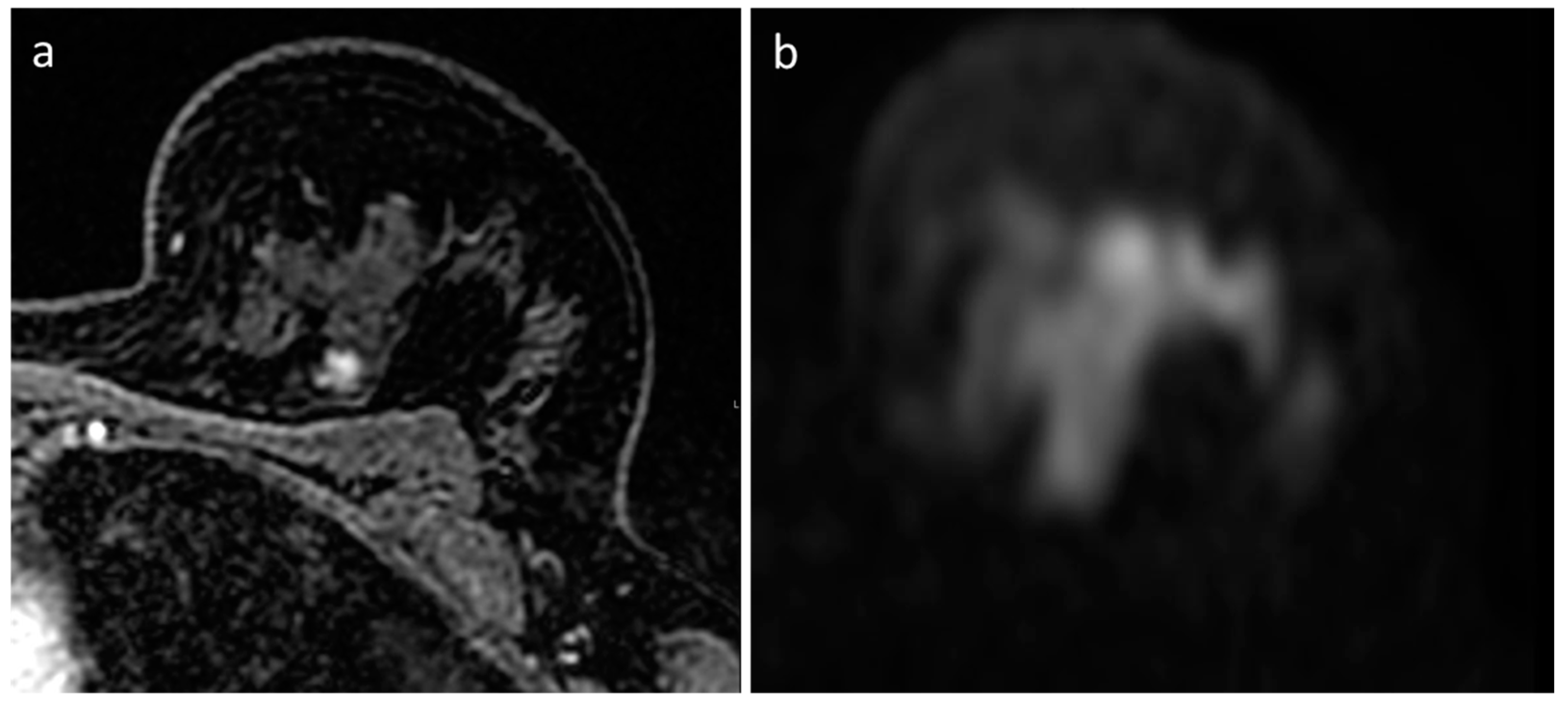 Diagnostics 13 01996 g004