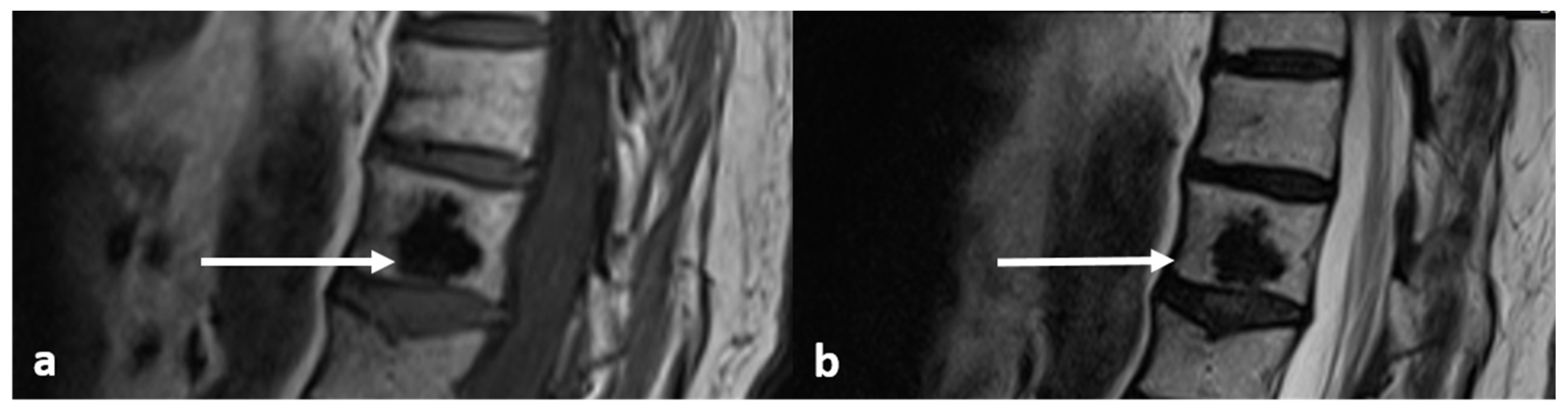 Diagnostics 13 02006 g002 Diagnostics 13 02006 g002