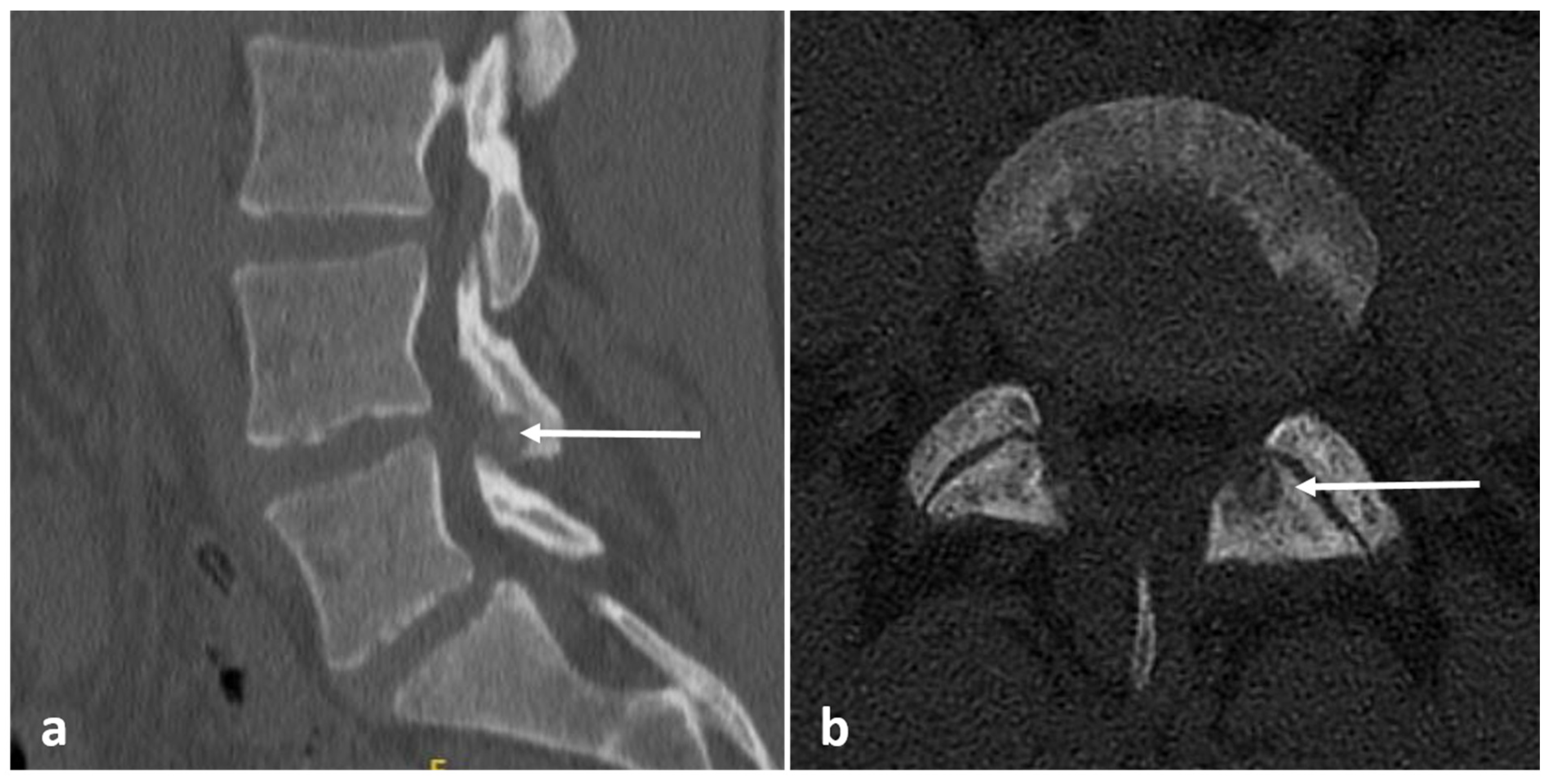 Diagnostics 13 02006 g003 Diagnostics 13 02006 g003