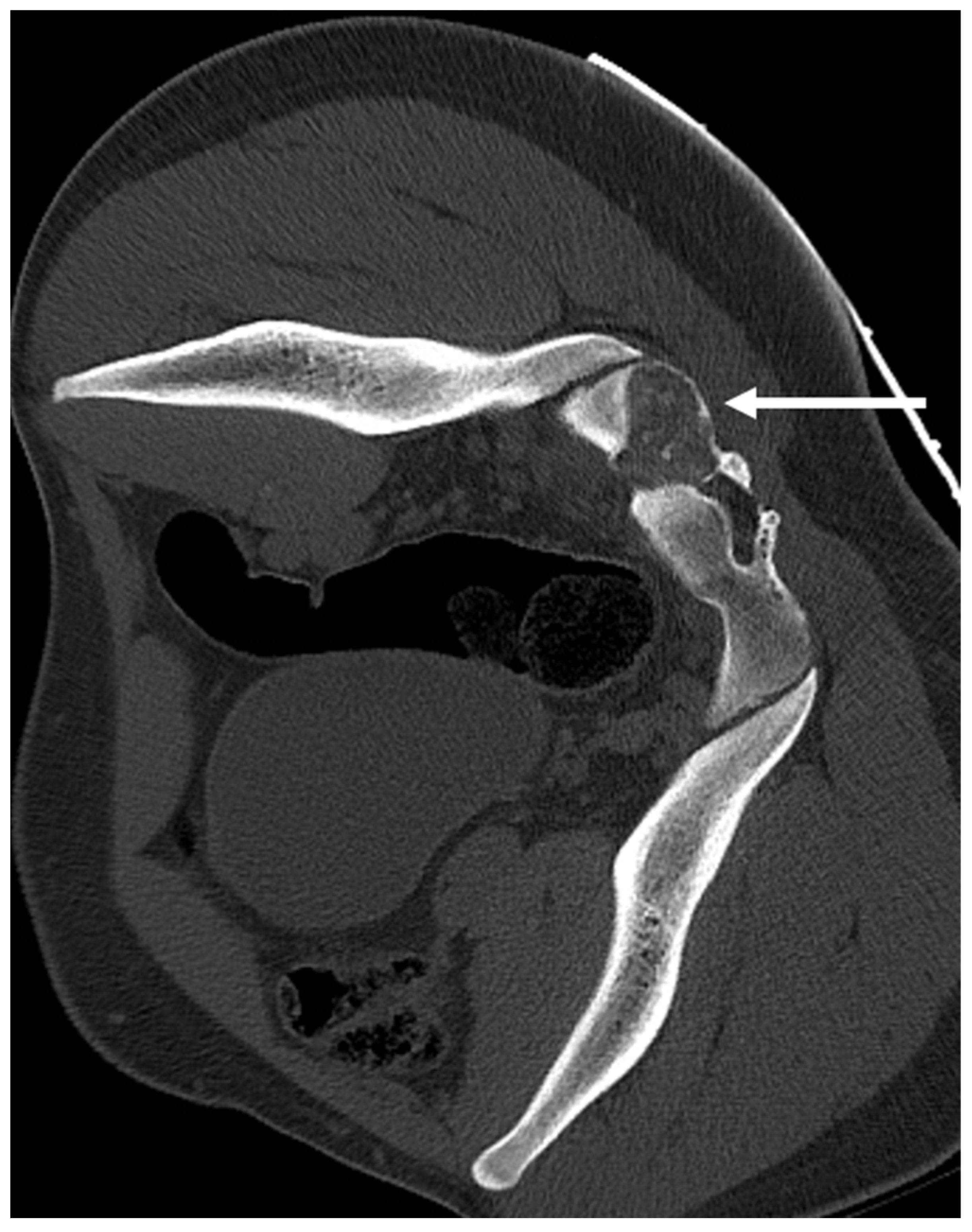 Diagnostics 13 02006 g006 Diagnostics 13 02006 g006