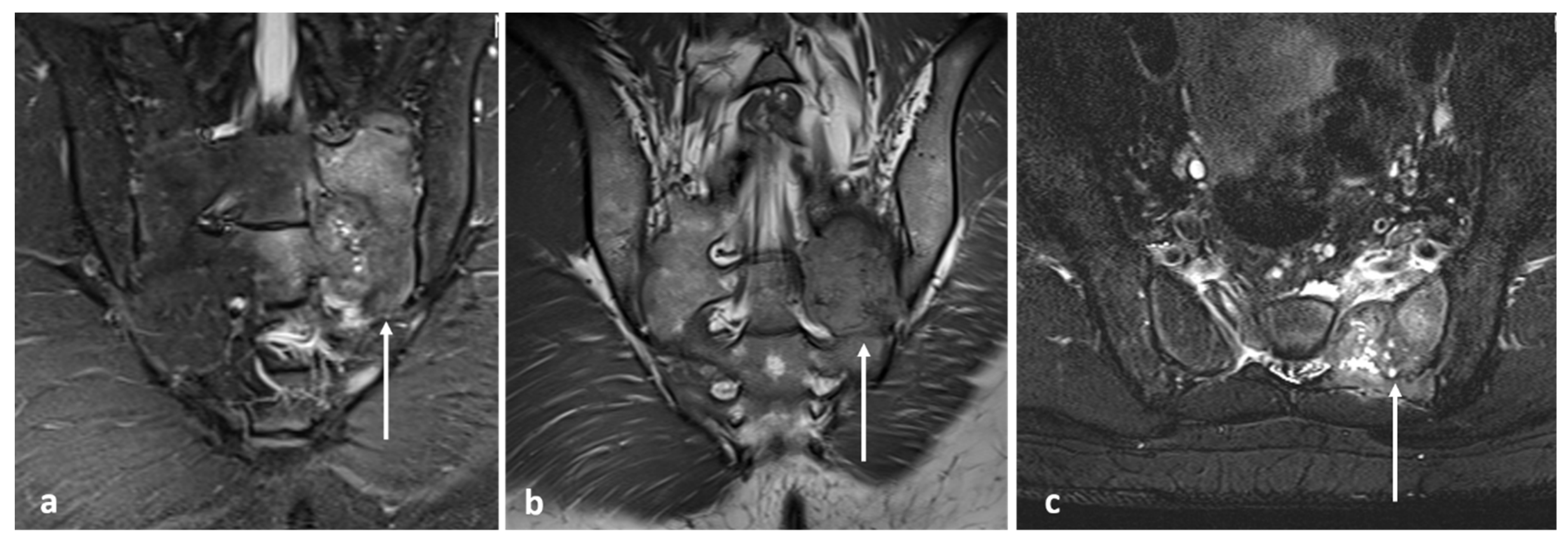 Diagnostics 13 02006 g007 Diagnostics 13 02006 g007