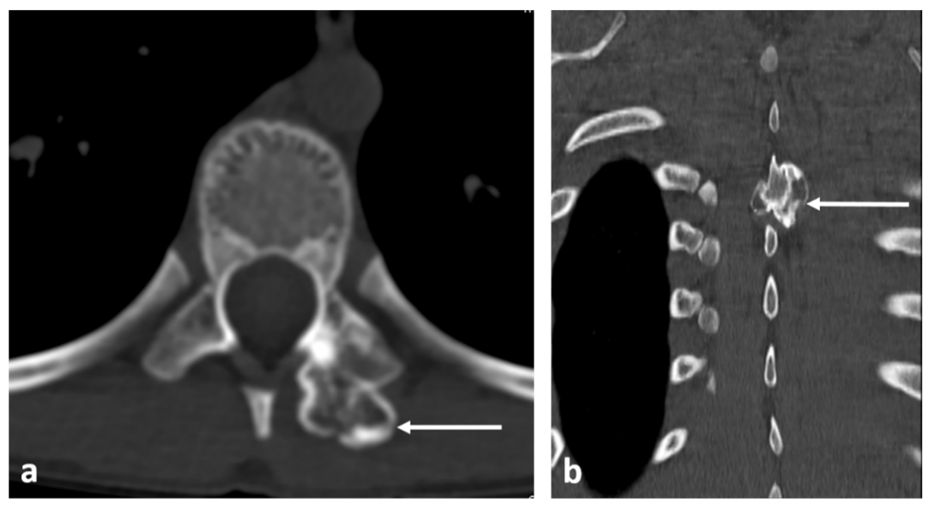 Diagnostics 13 02006 g011 Diagnostics 13 02006 g011