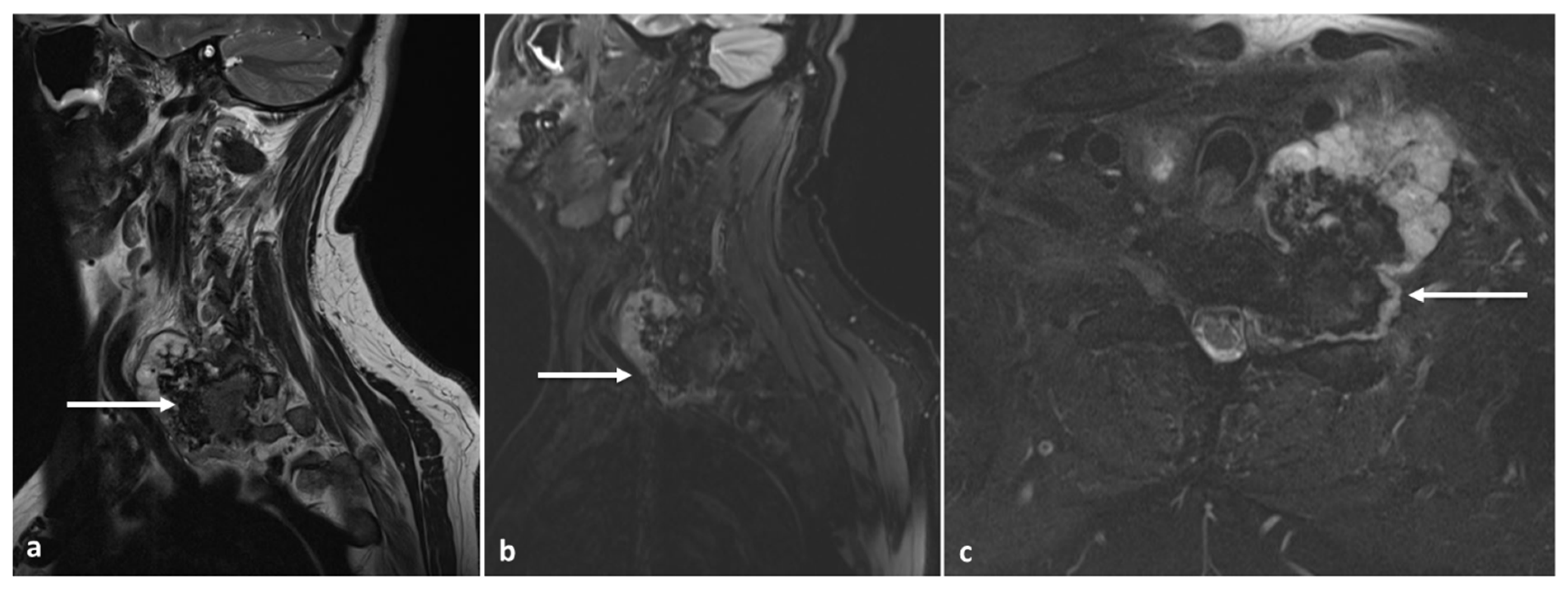 Diagnostics 13 02006 g012 Diagnostics 13 02006 g012