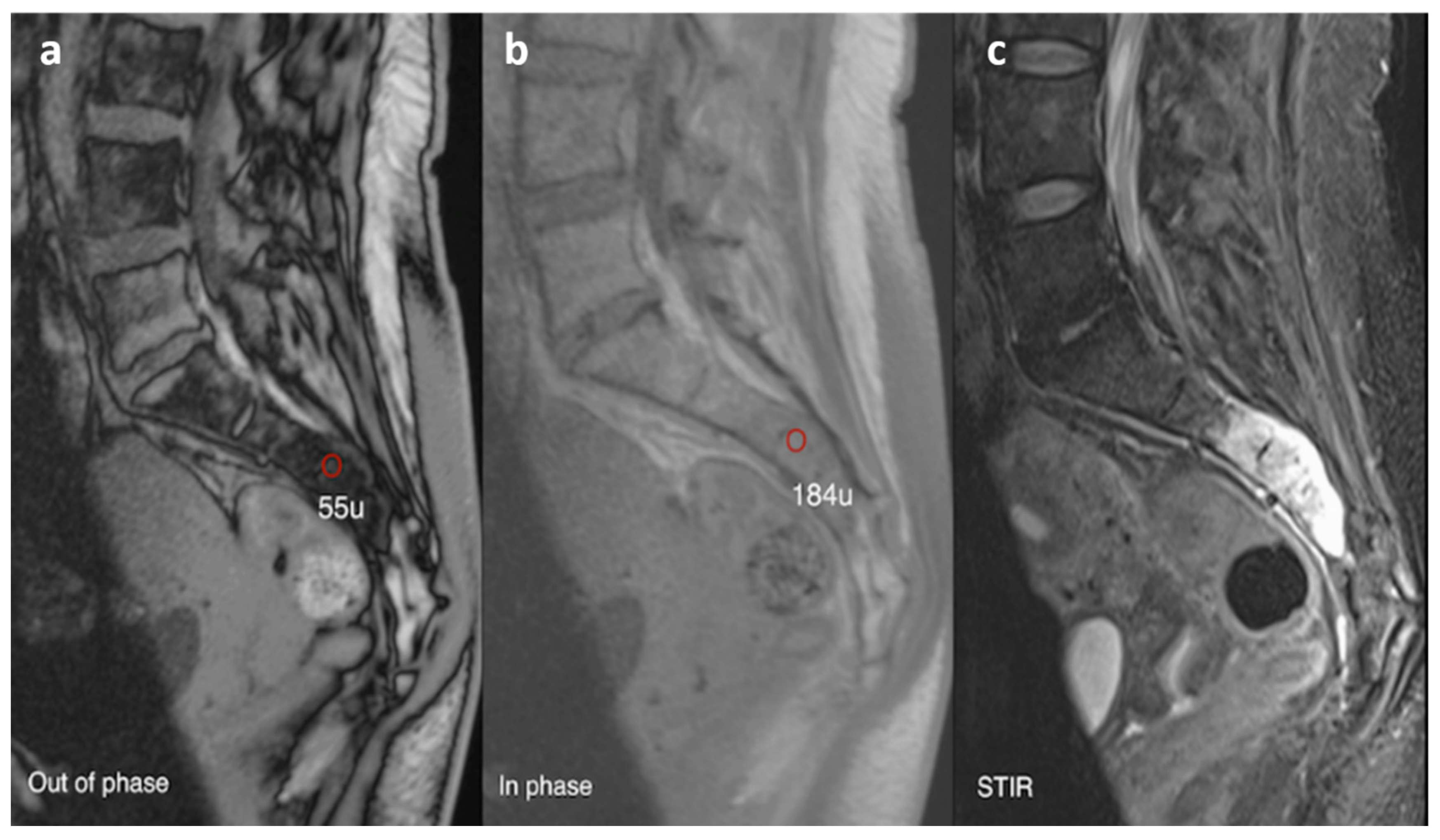 Diagnostics 13 02006 g015 Diagnostics 13 02006 g015