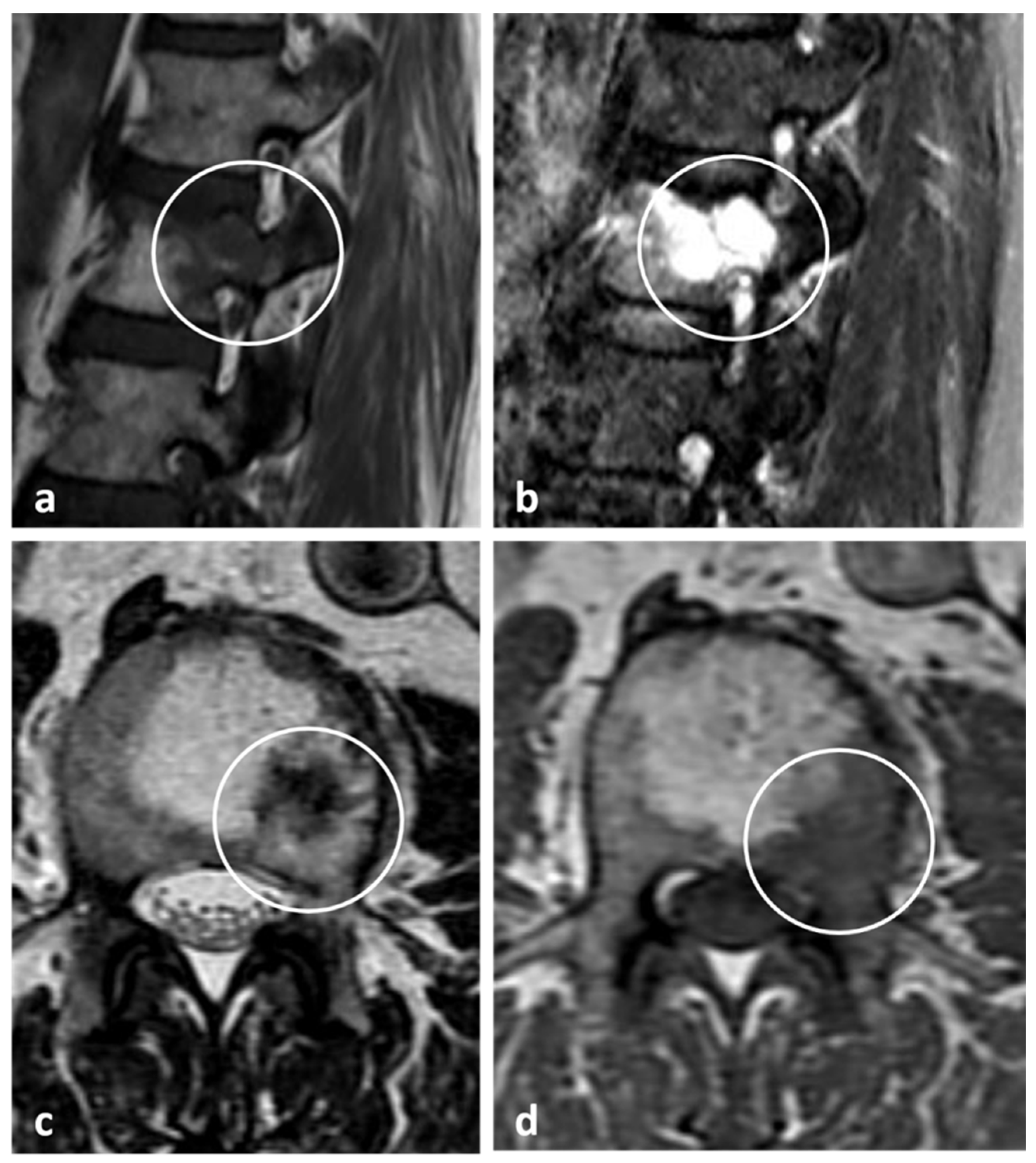 Diagnostics 13 02006 g018 Diagnostics 13 02006 g018