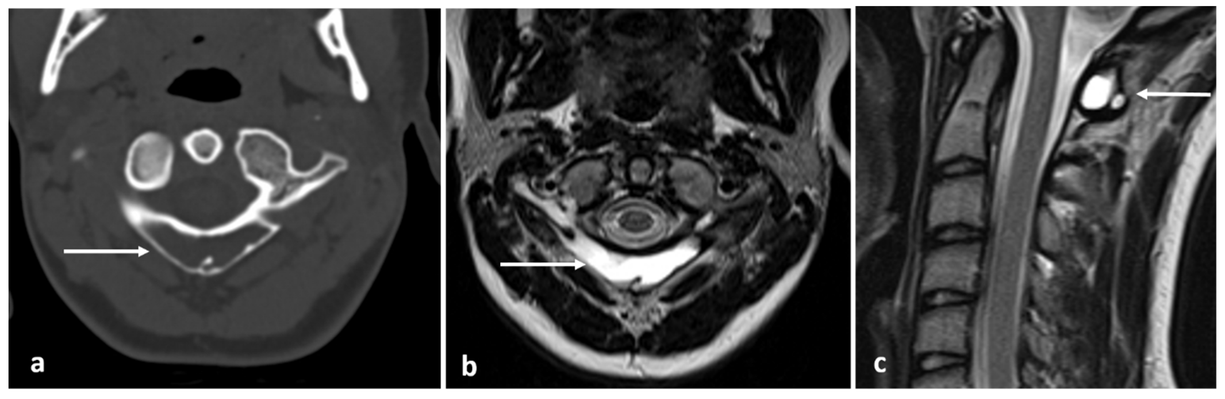 Diagnostics 13 02006 g019 Diagnostics 13 02006 g019