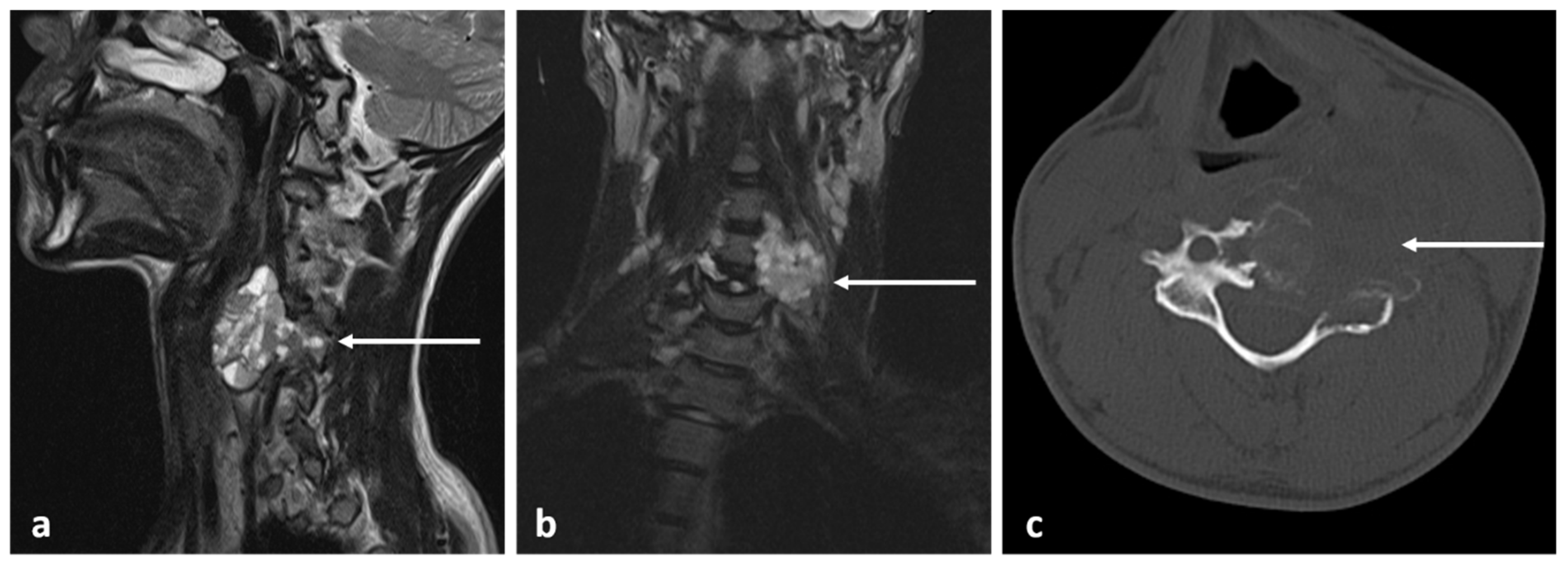Diagnostics 13 02006 g020 Diagnostics 13 02006 g020