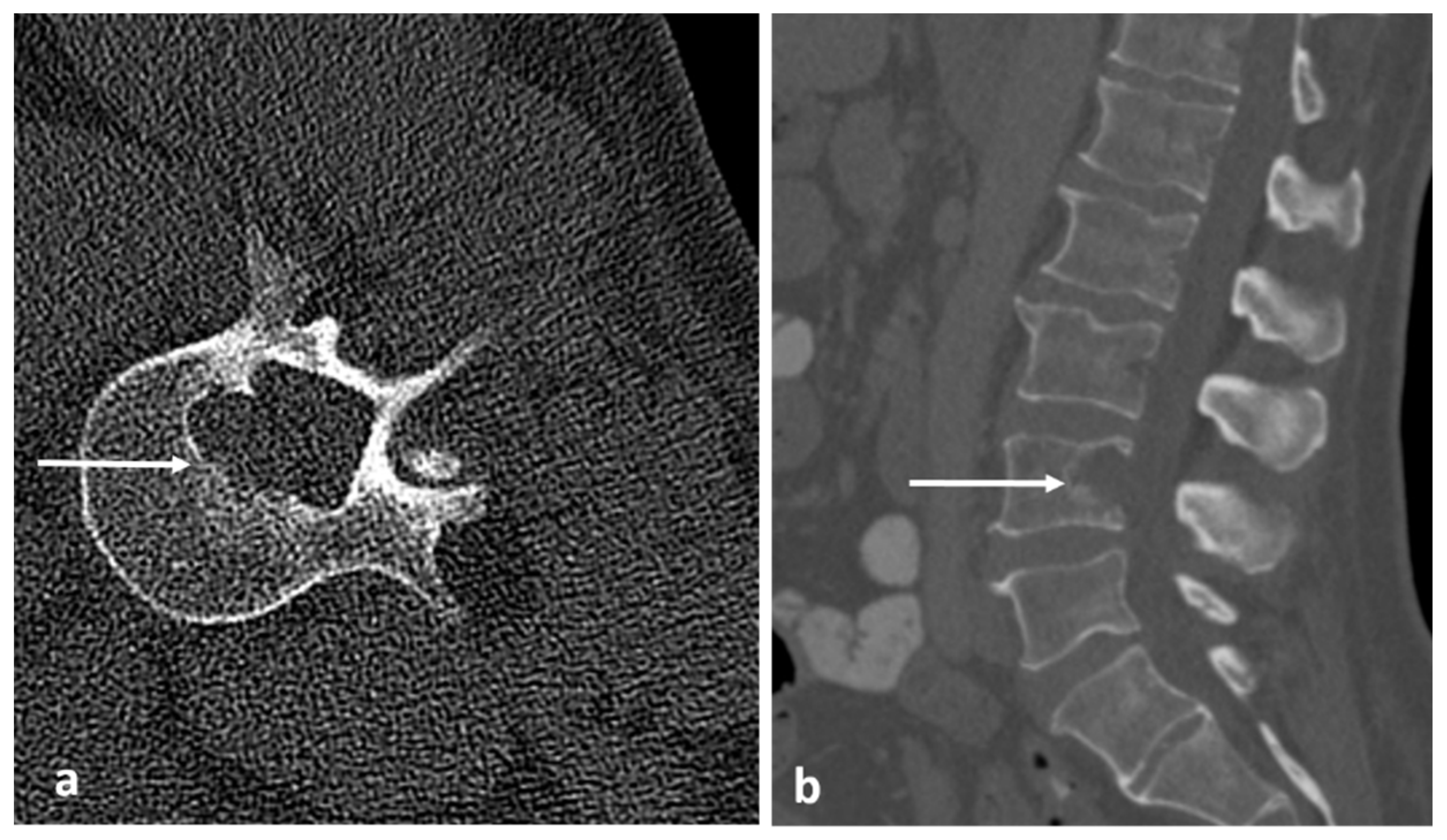 Diagnostics 13 02006 g021 Diagnostics 13 02006 g021