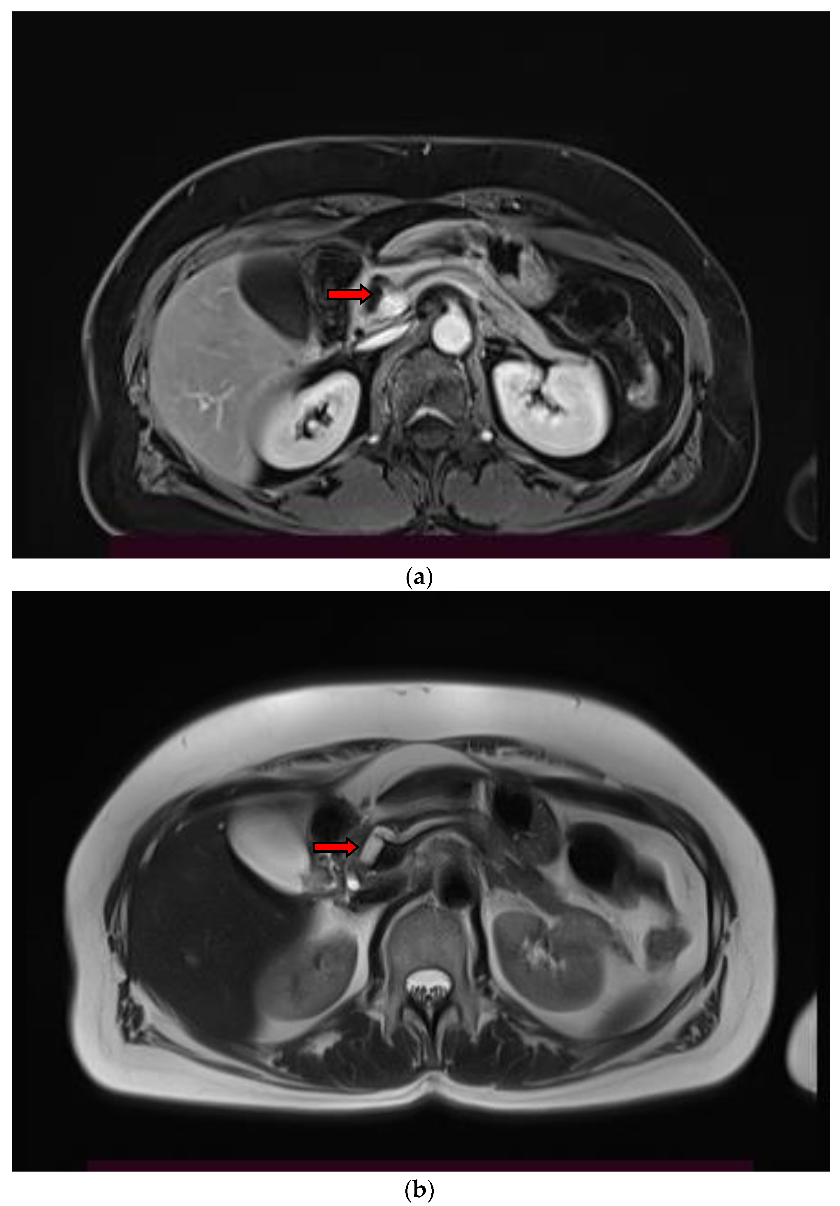 Diagnostics 13 02015 g002