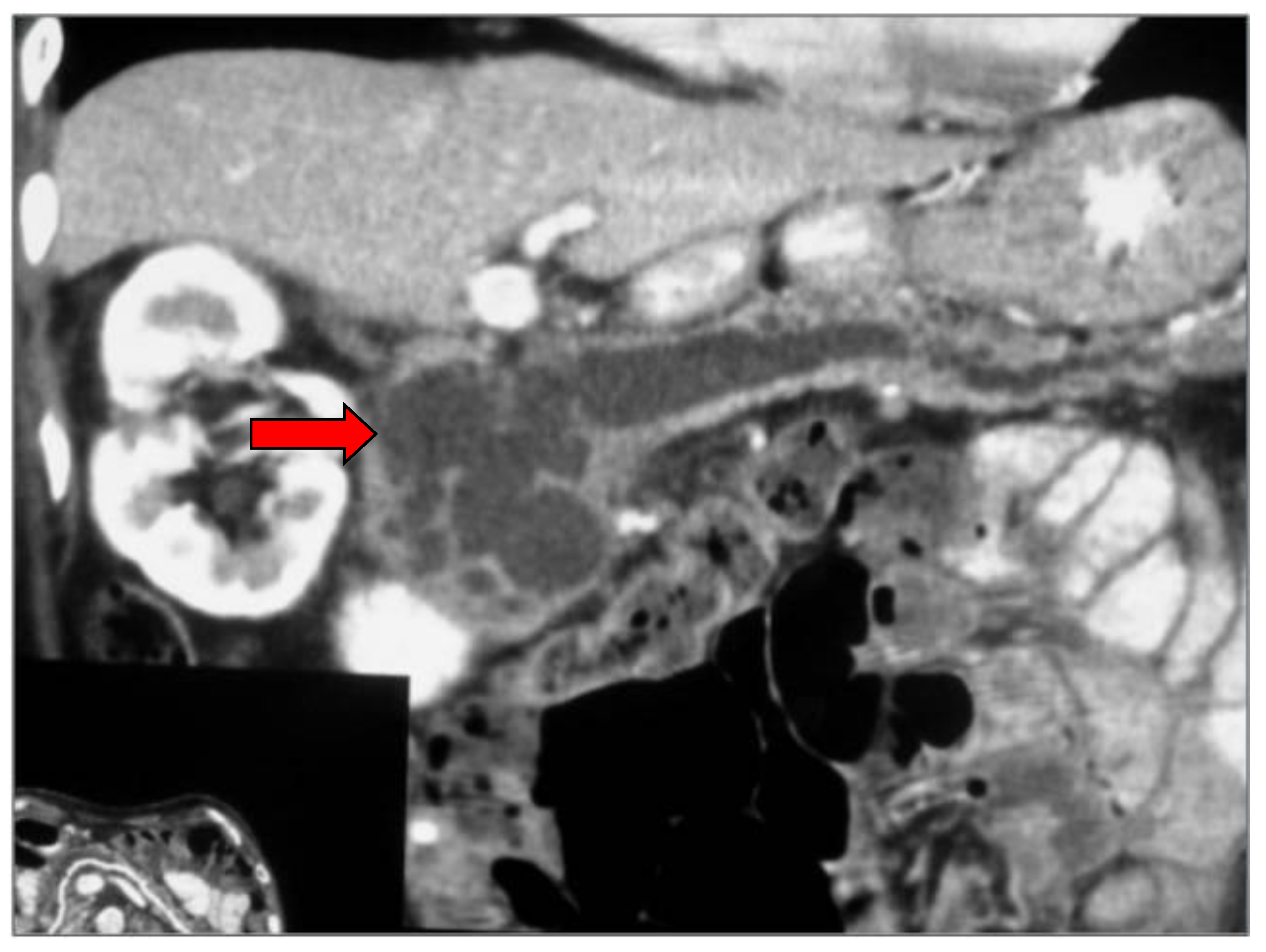 Diagnostics 13 02015 g004