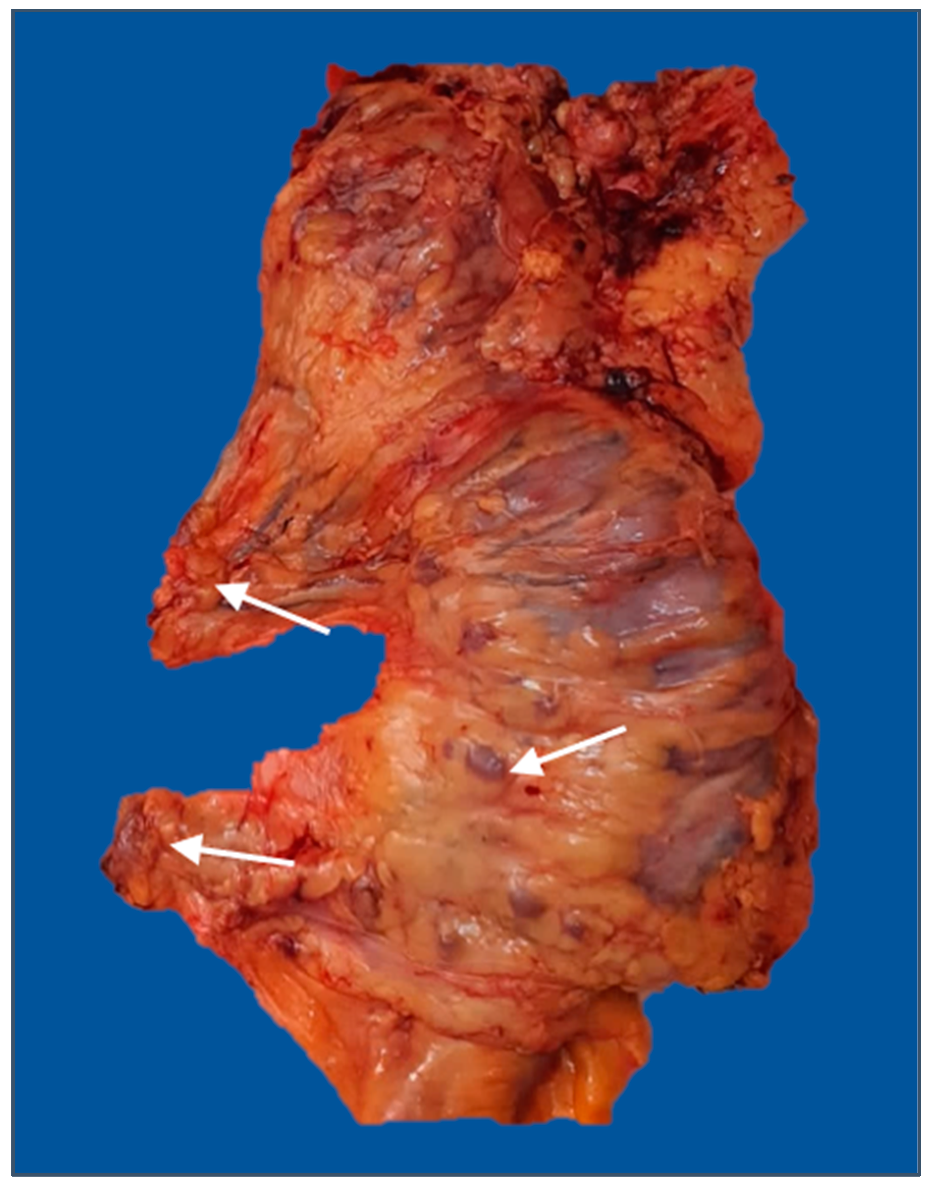 Diagnostics 13 02016 g004