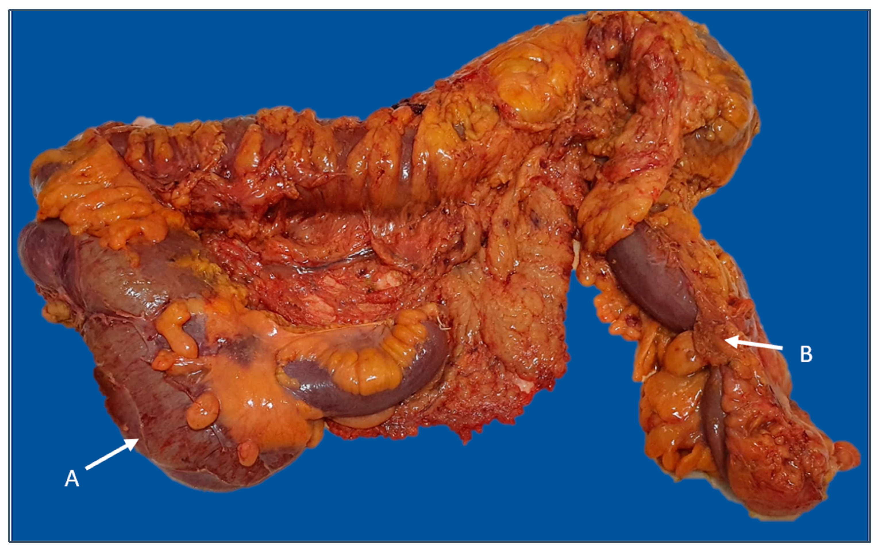 Diagnostics 13 02016 g005