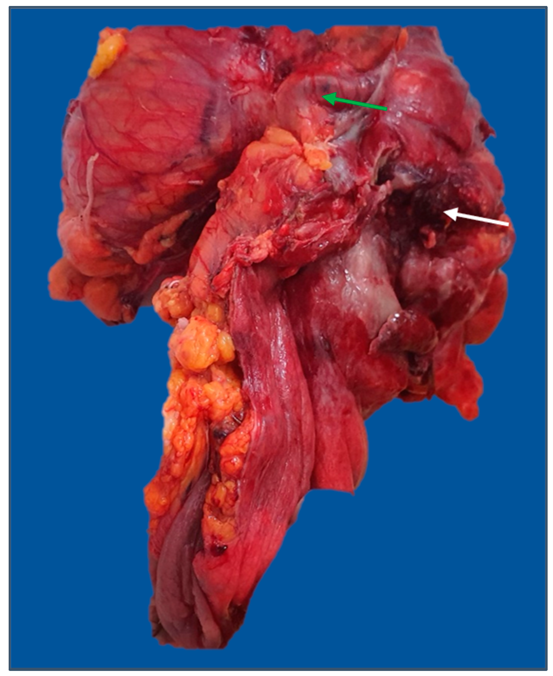 Diagnostics 13 02016 g006