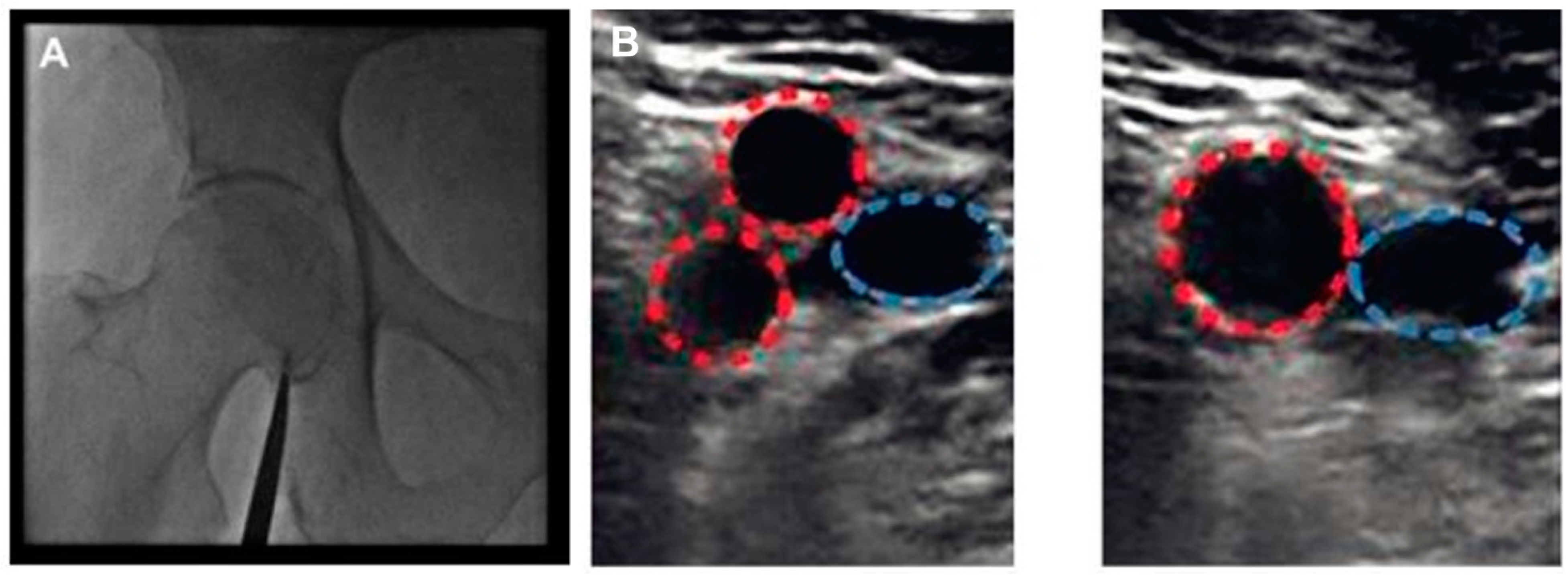 Diagnostics 13 02028 g002 Diagnostics 13 02028 g002