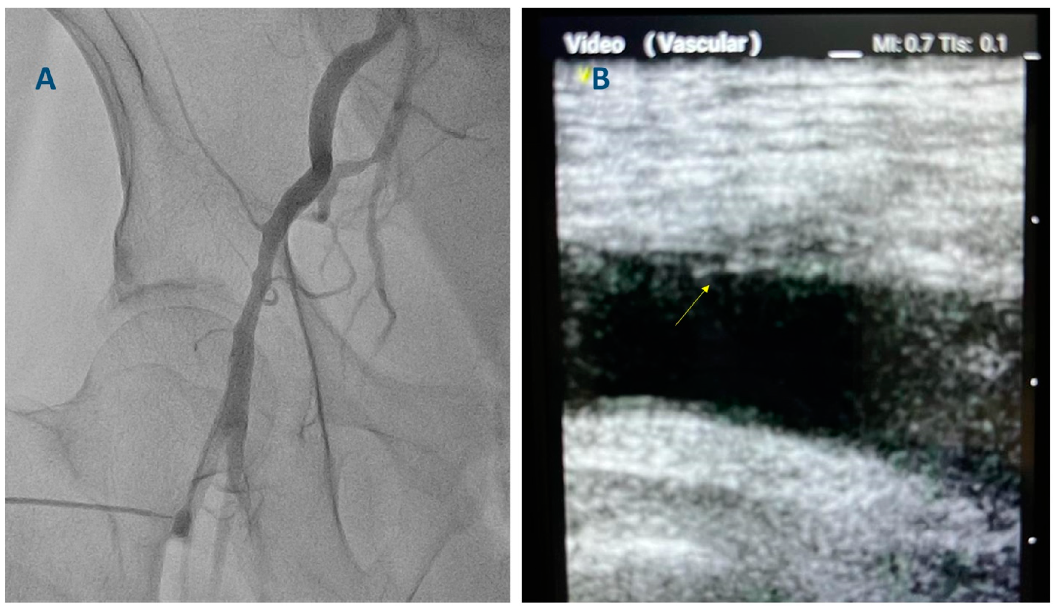 Diagnostics 13 02028 g004 Diagnostics 13 02028 g004