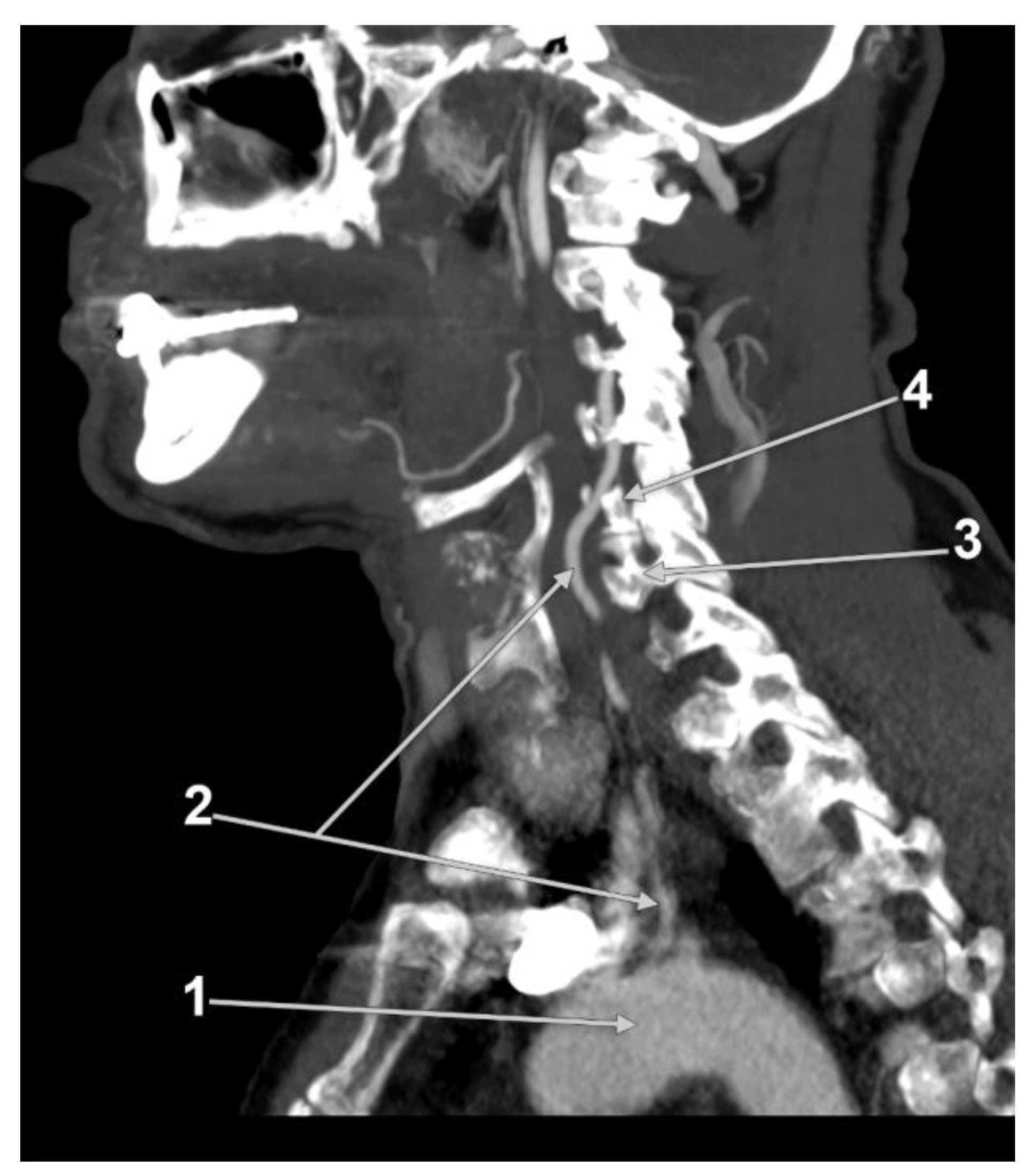 Diagnostics 13 02036 g029 Diagnostics 13 02036 g029