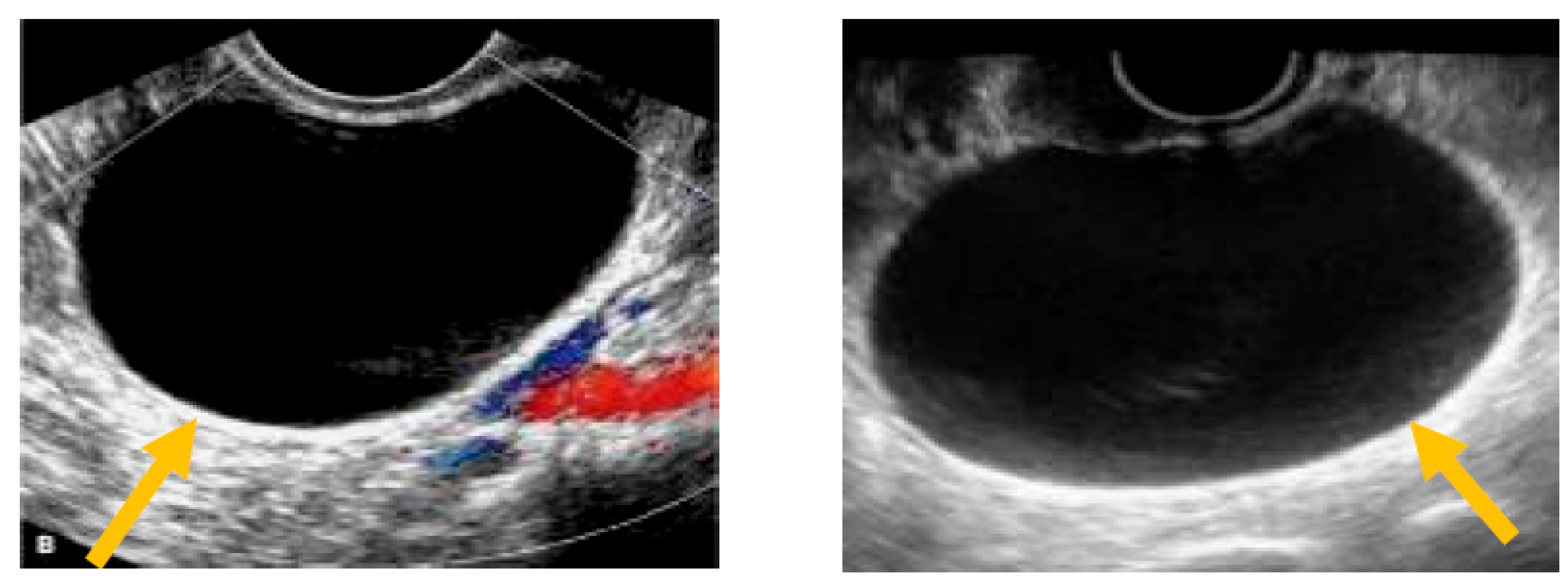 Diagnostics free full text advantages and limitations of ultrasound