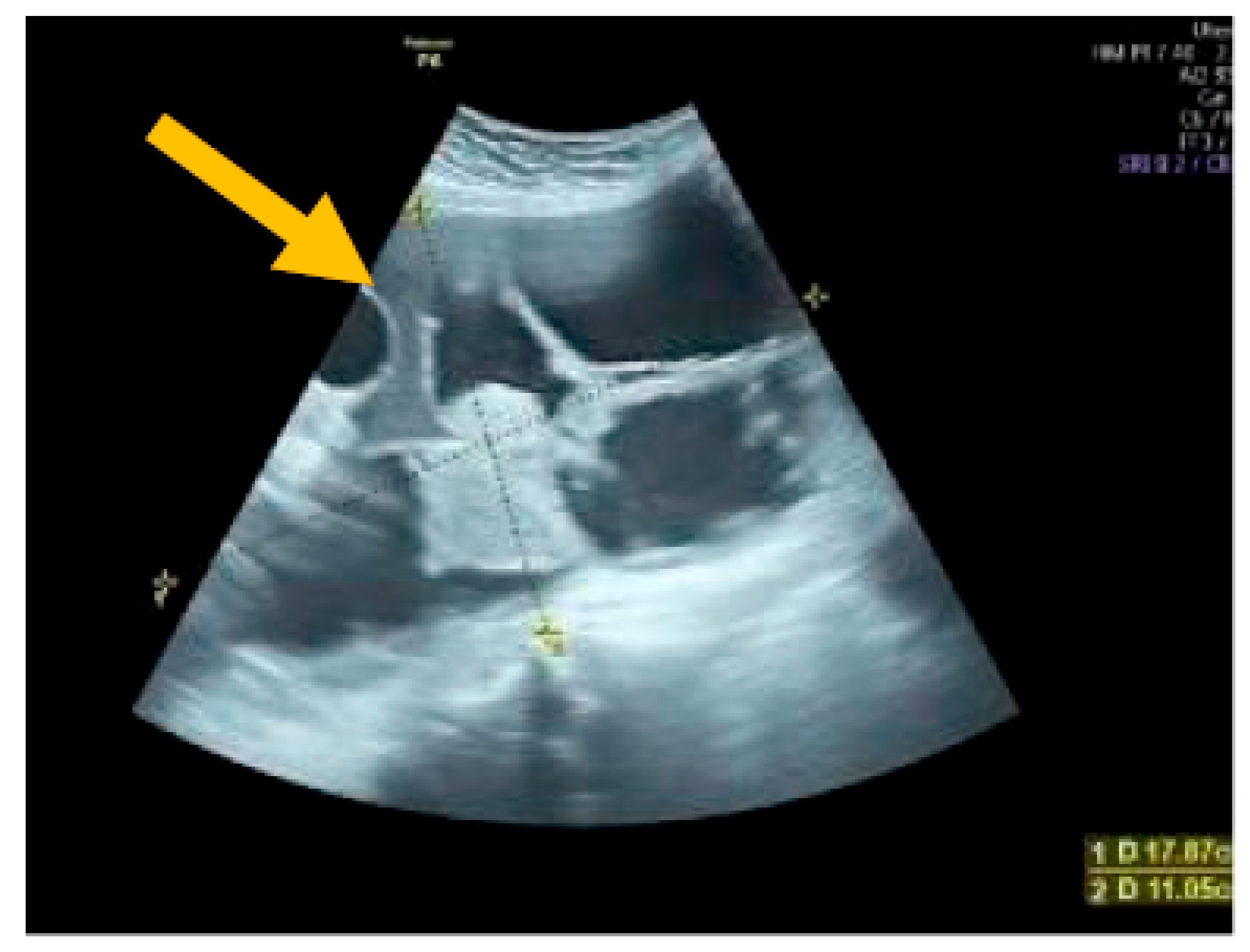 Diagnostics 13 02078 g002