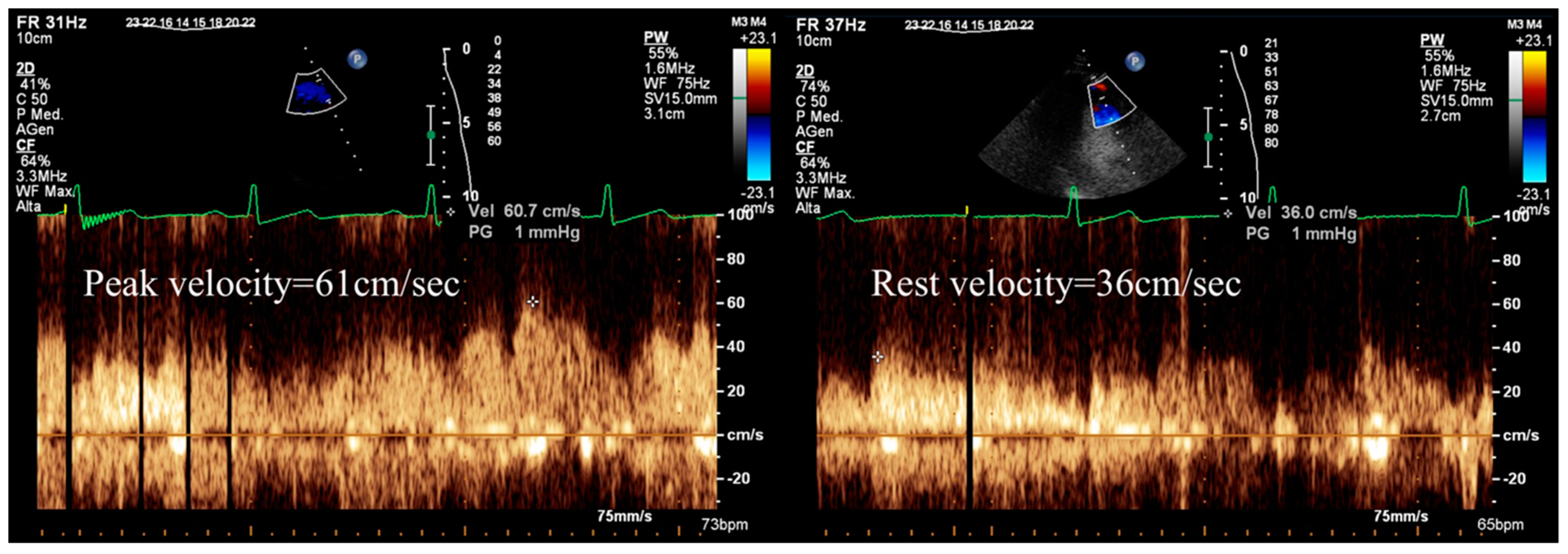 Diagnostics 13 02083 g002 Diagnostics 13 02083 g002