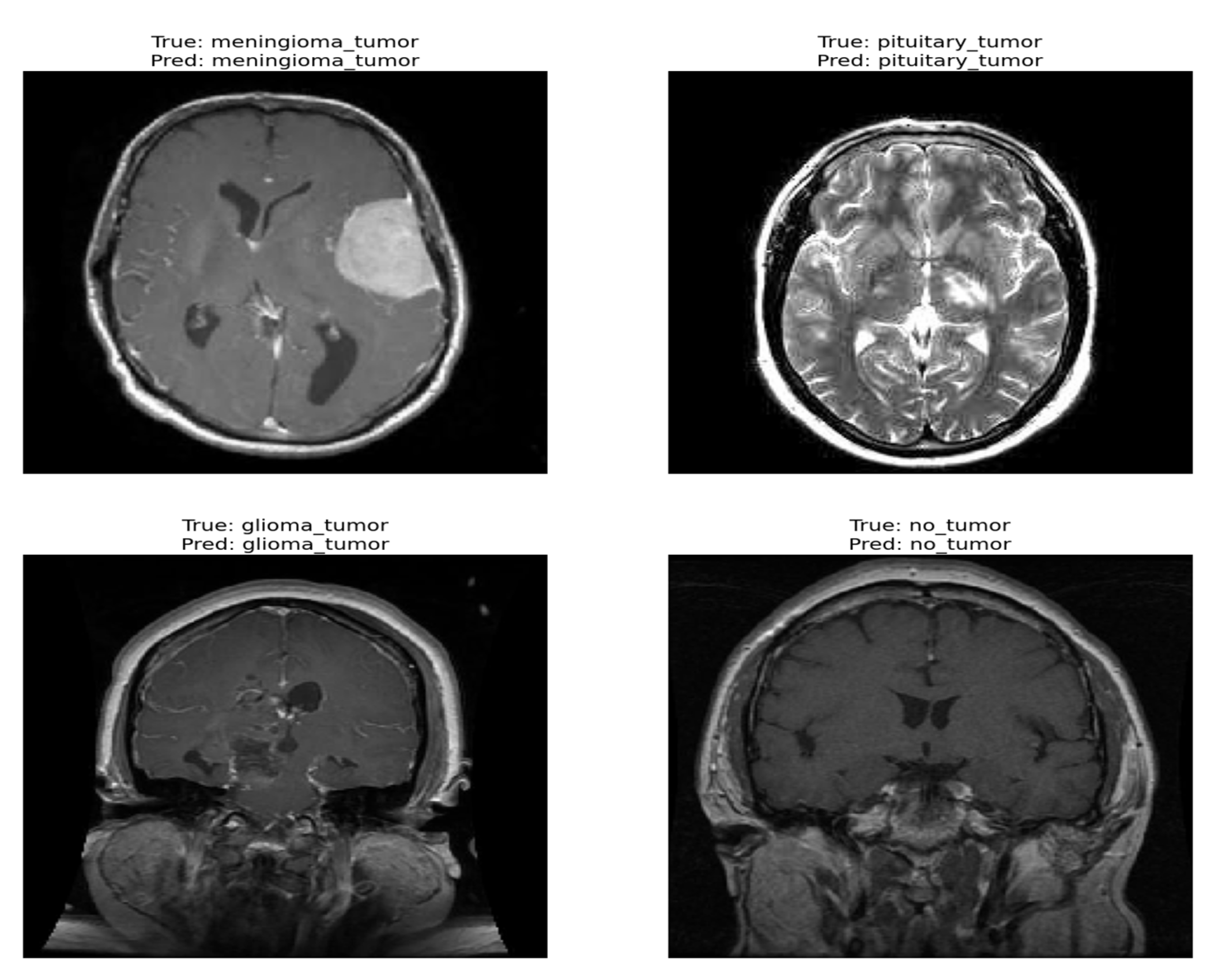 Diagnostics 13 02094 g005