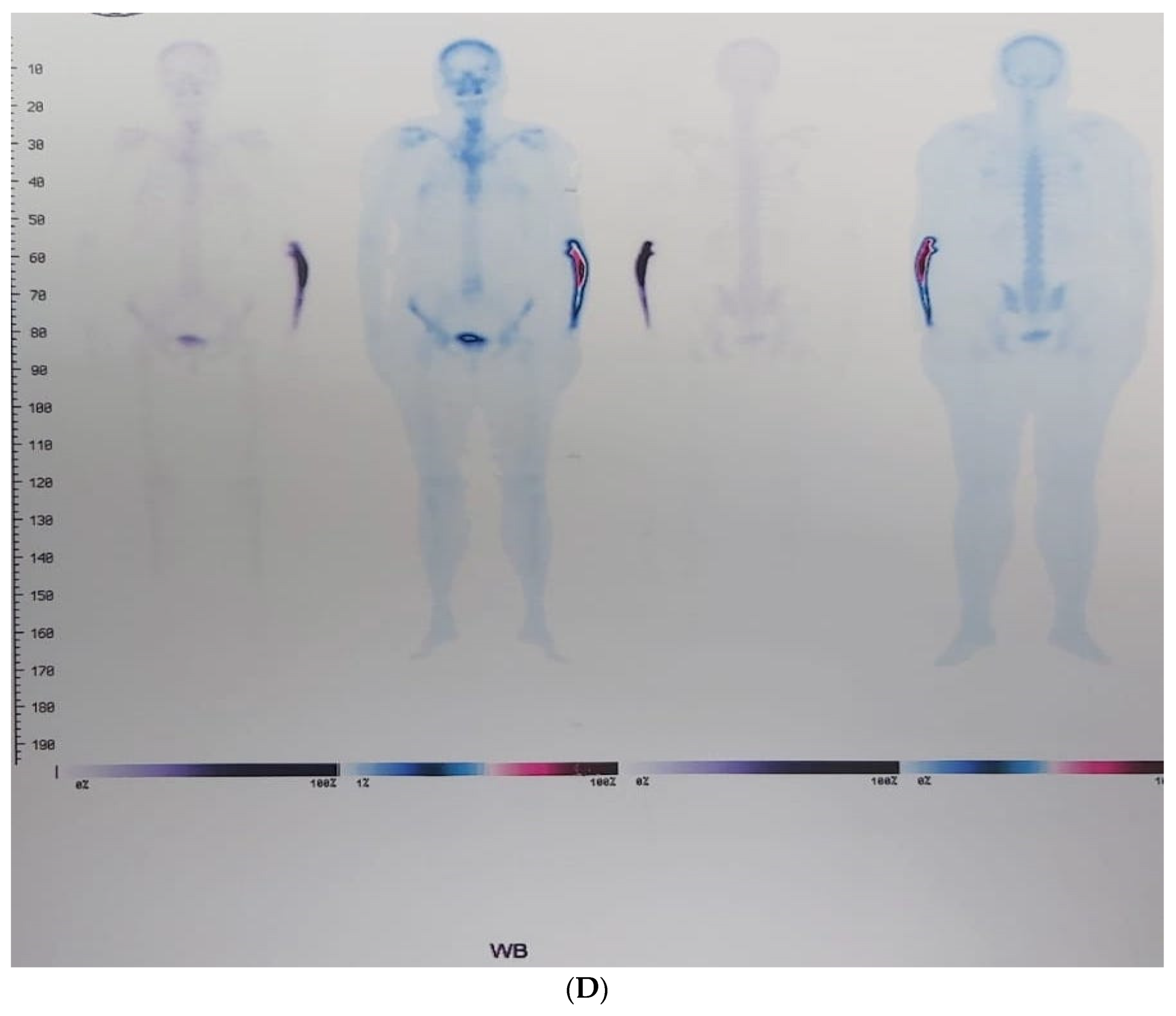 Diagnostics 13 02101 g001c Diagnostics 13 02101 g001c