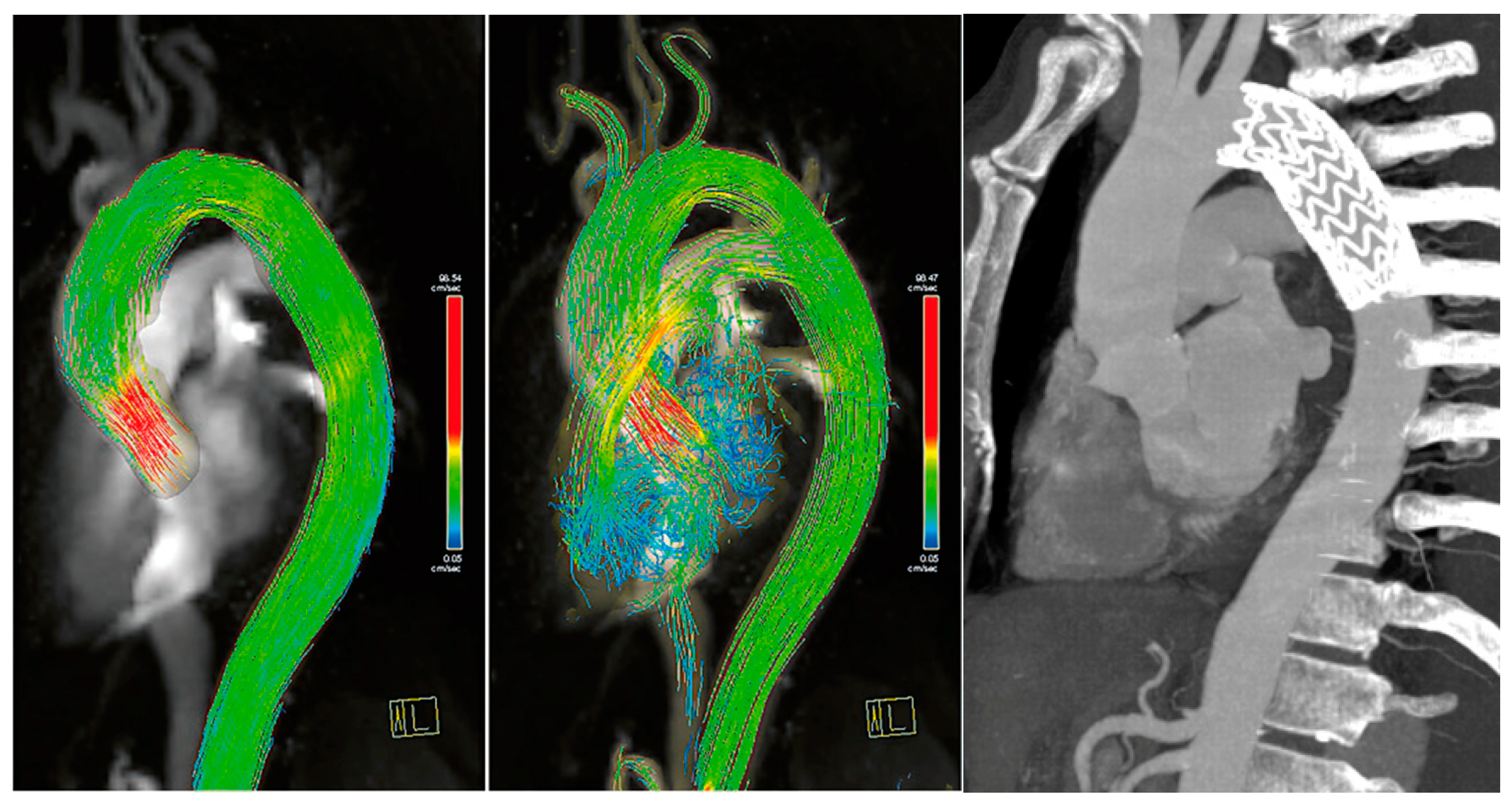 Diagnostics 13 02113 g005