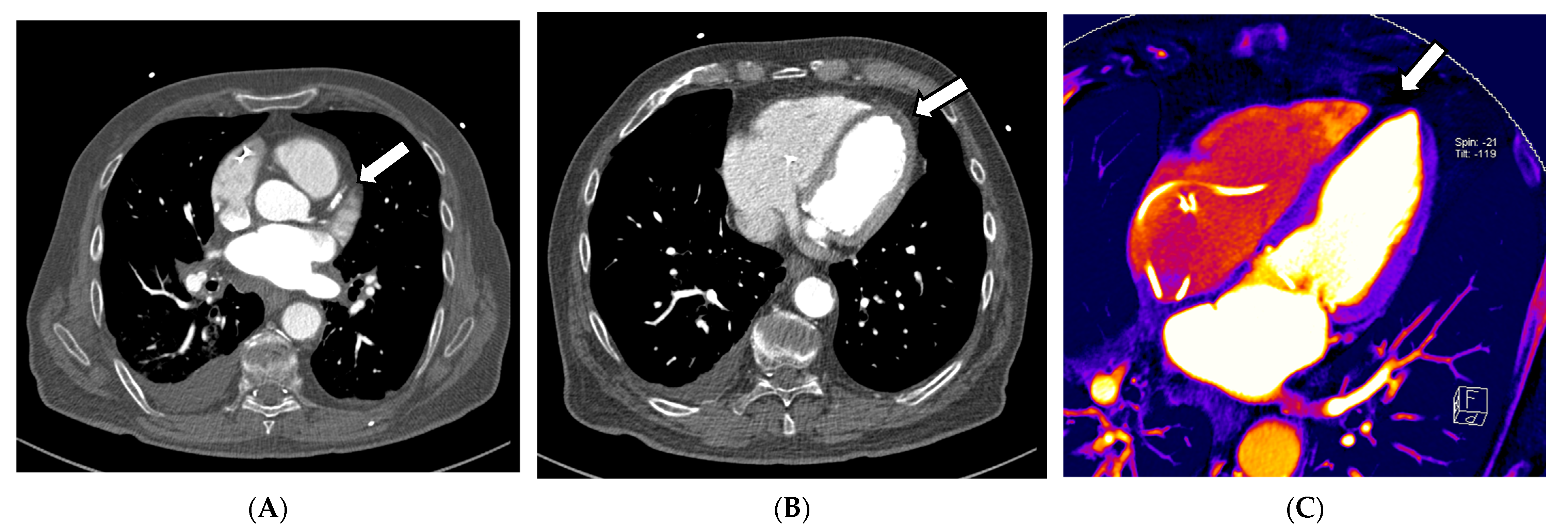 Diagnostics 13 02116 g003a Diagnostics 13 02116 g003a