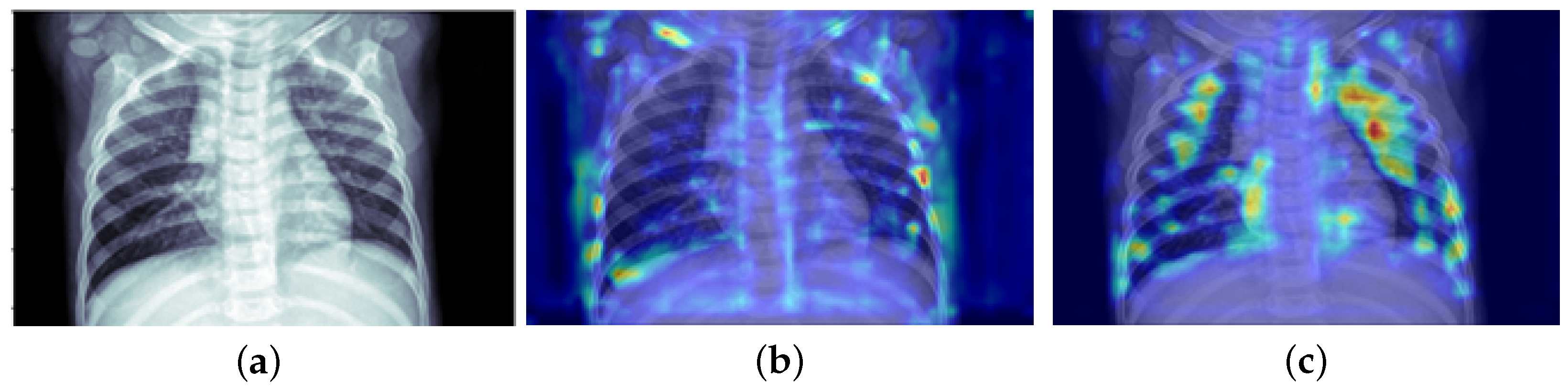 Diagnostics 13 02125 g007